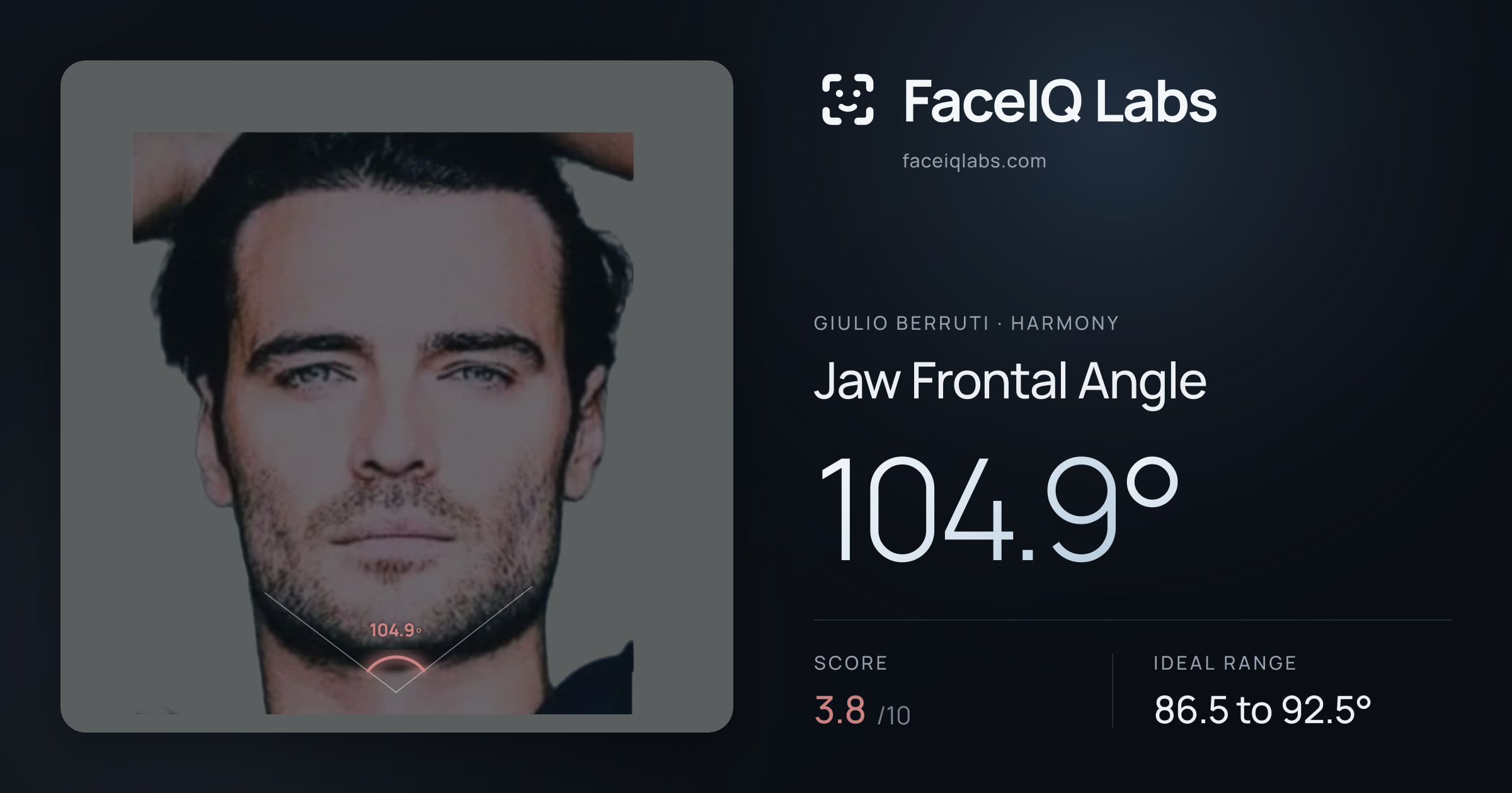 Giulio Berruti Jaw Frontal Angle: 104.9°, drawn on the photo