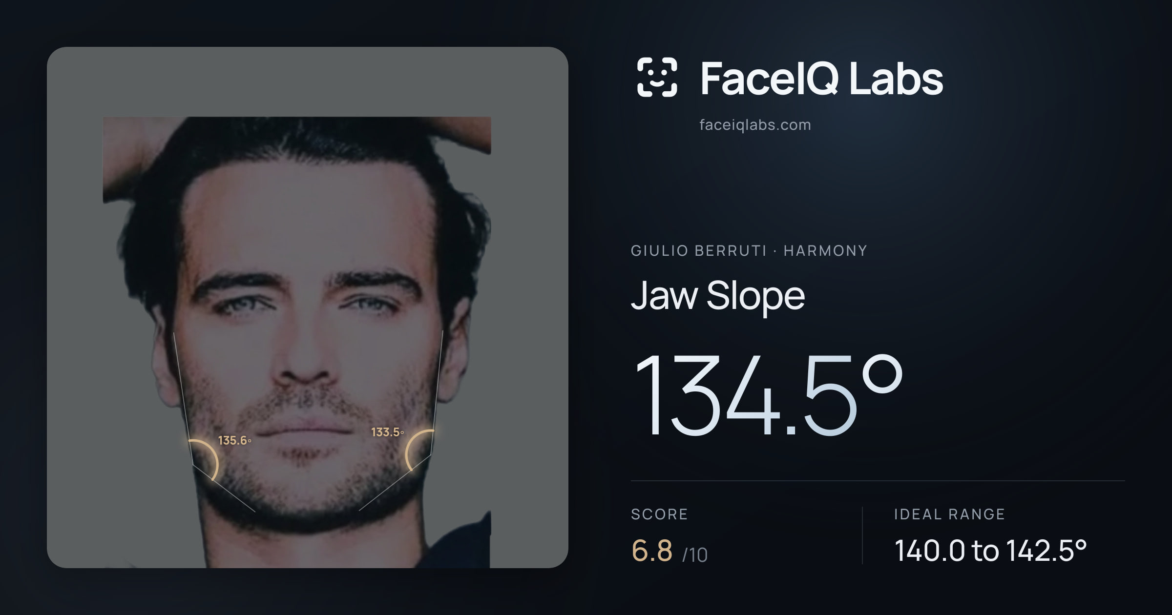 Giulio Berruti Jaw Slope: 134.5°, drawn on the photo