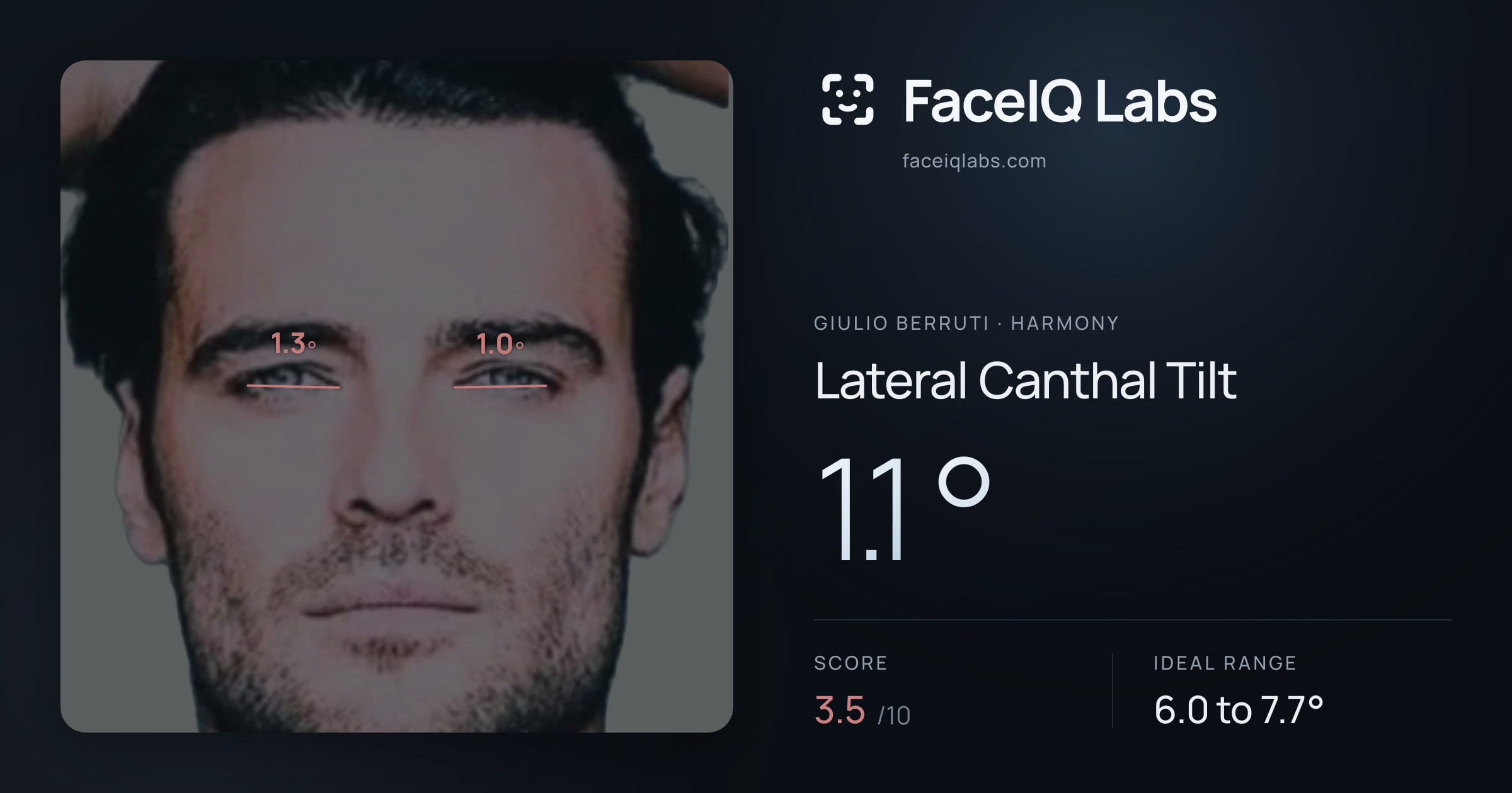 Giulio Berruti Lateral Canthal Tilt: 1.1°, drawn on the photo