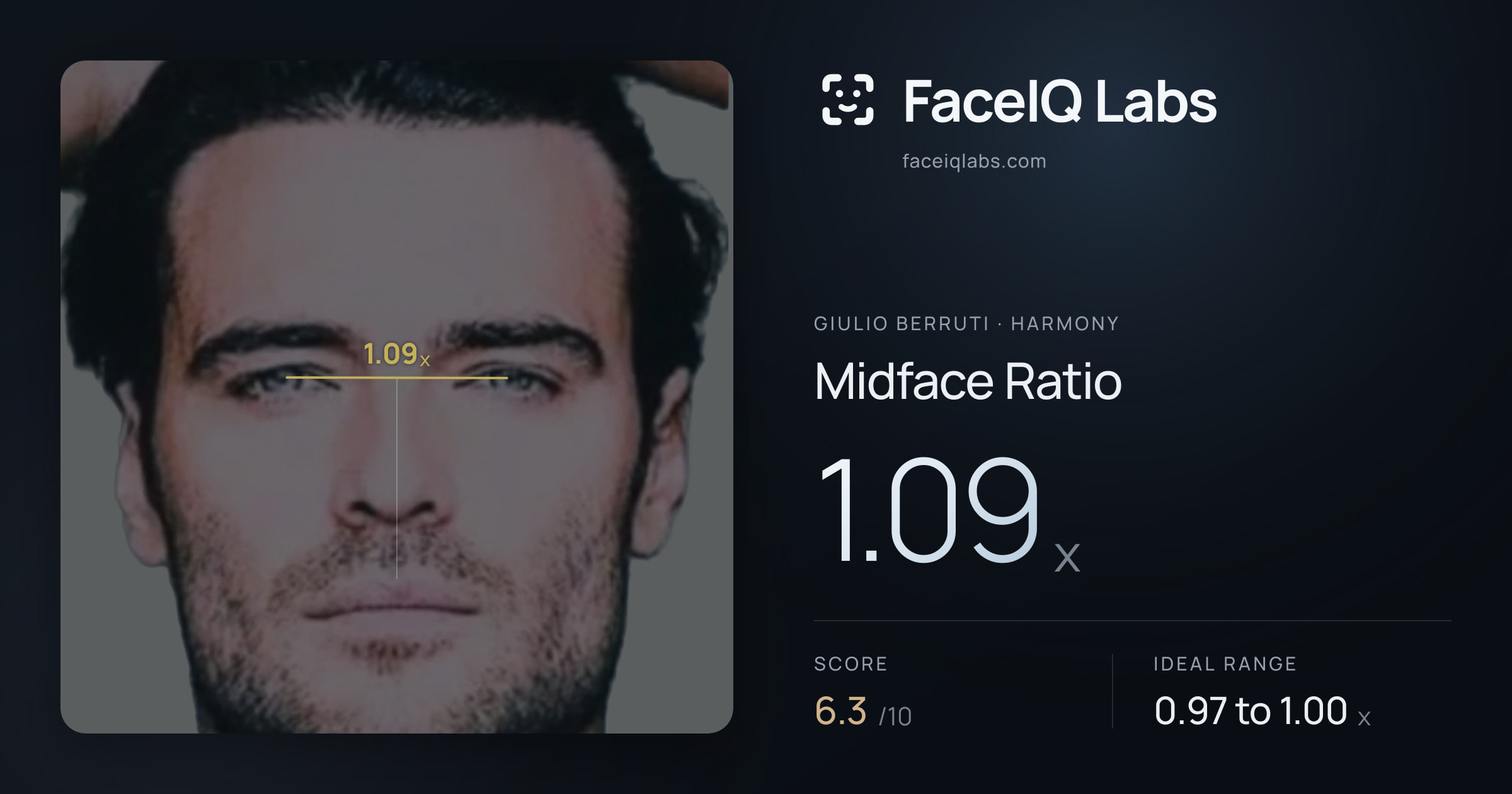 Giulio Berruti Midface Ratio: 1.09x, drawn on the photo