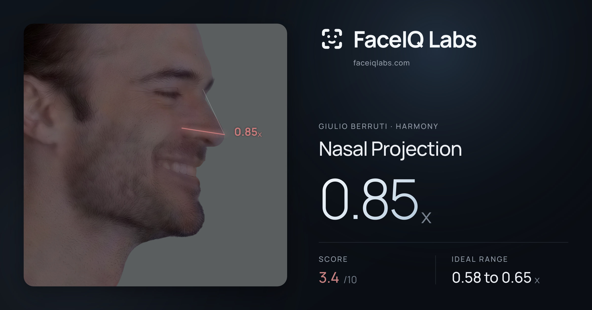 Giulio Berruti Nasal Projection: 0.85x, drawn on the photo