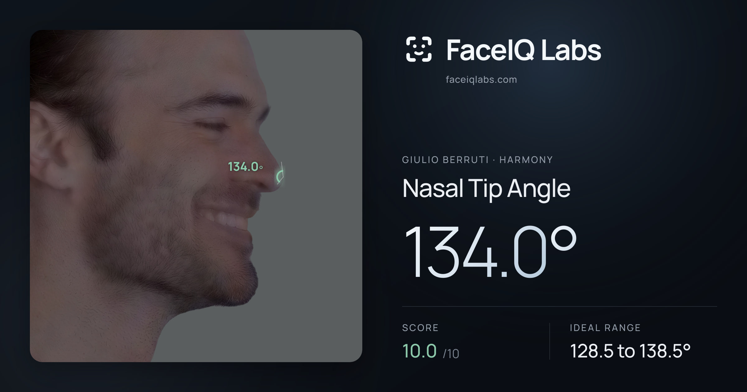Giulio Berruti Nasal Tip Angle: 134.0°, drawn on the photo