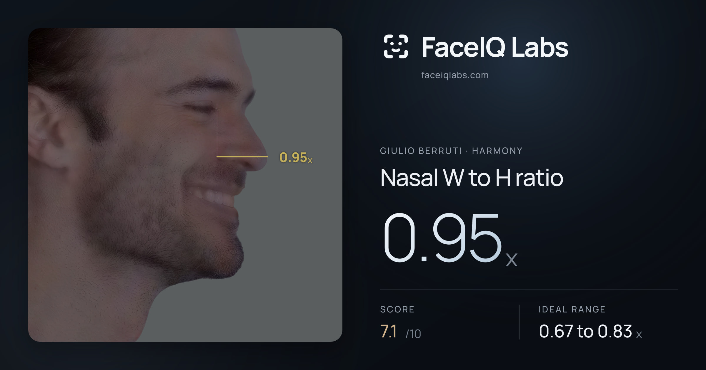 Giulio Berruti Nasal W to H ratio: 0.95x, drawn on the photo