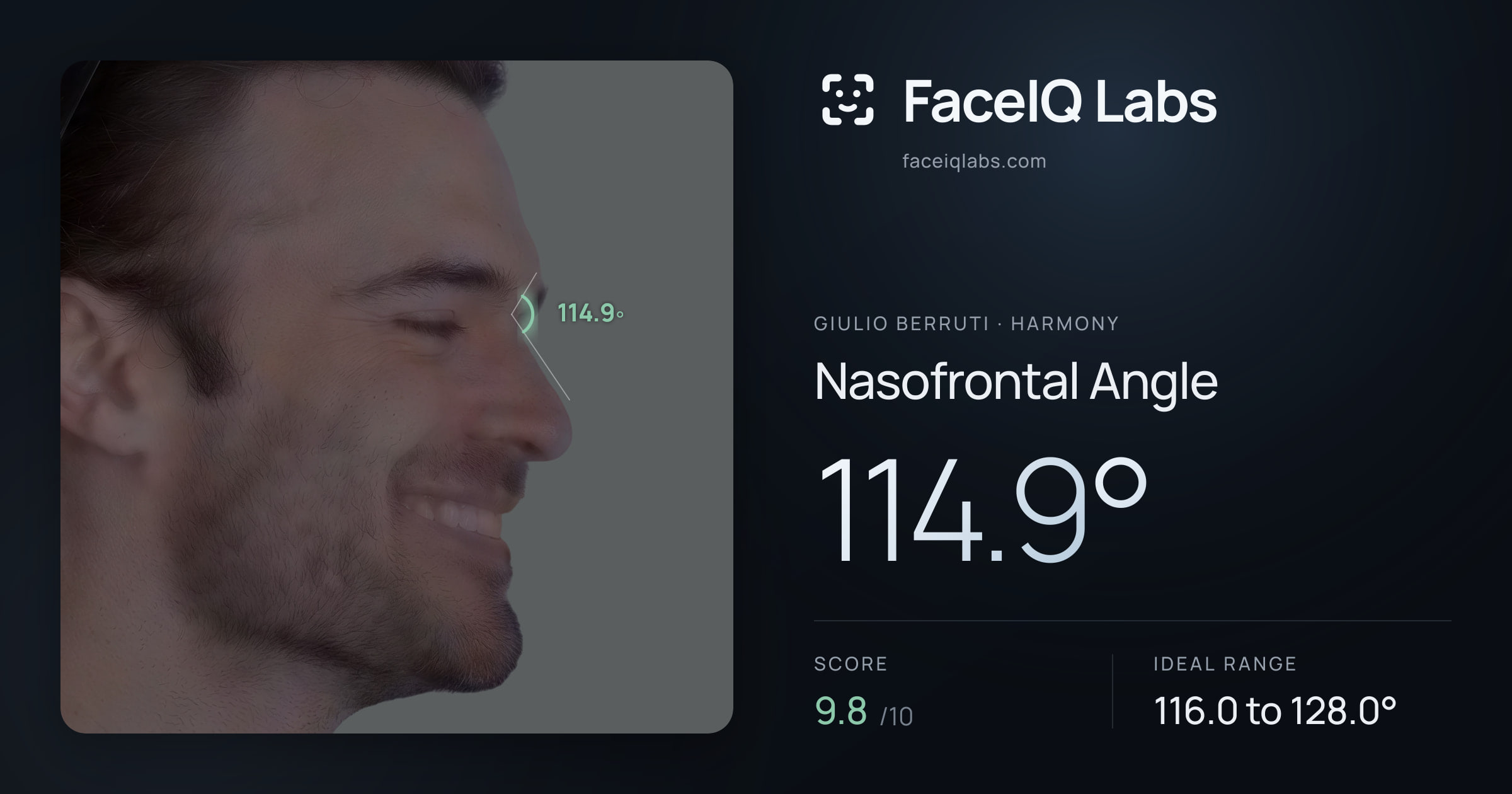 Giulio Berruti Nasofrontal Angle: 114.9°, drawn on the photo