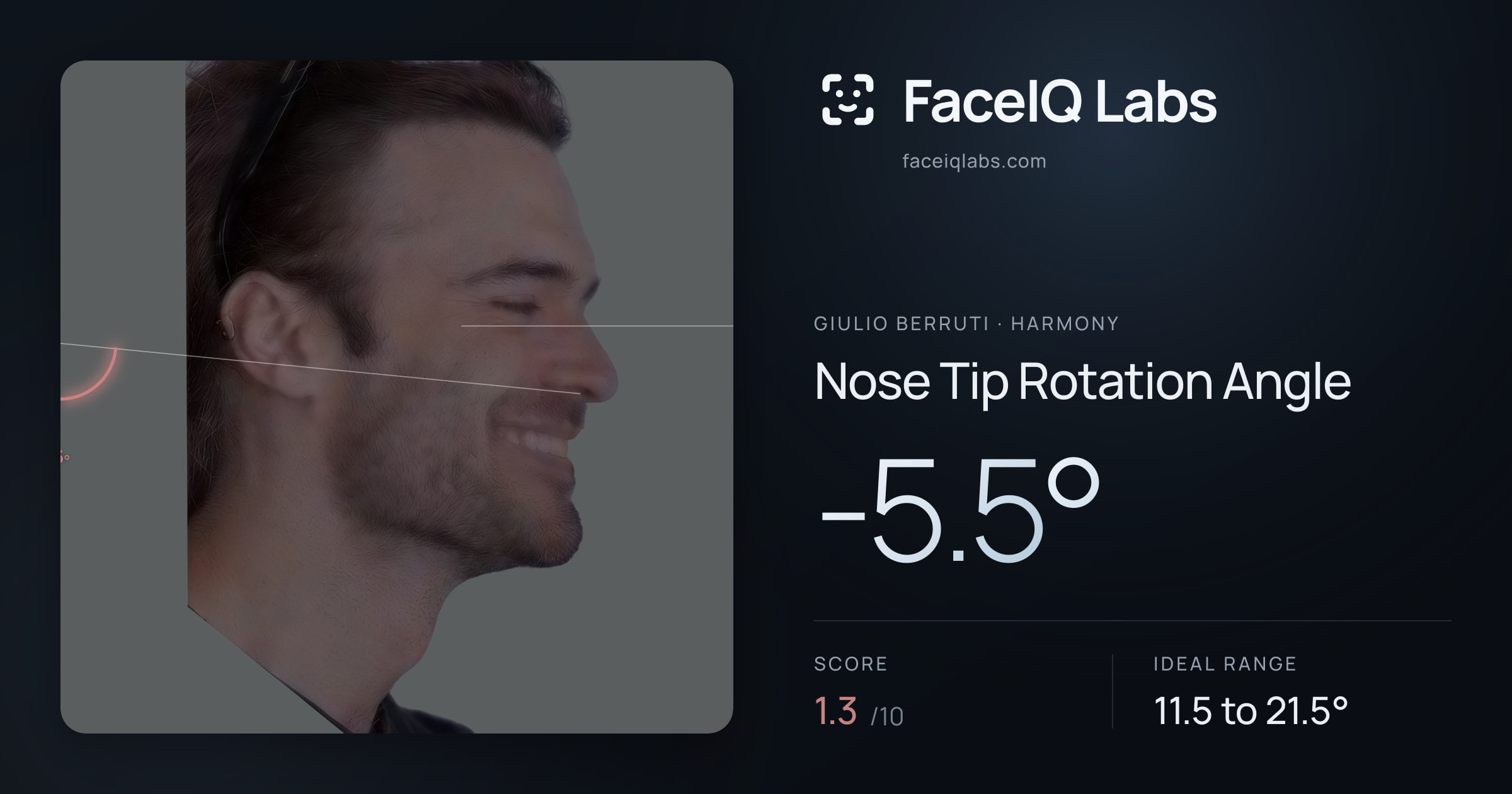 Giulio Berruti Nose Tip Rotation Angle: -5.5°, drawn on the photo