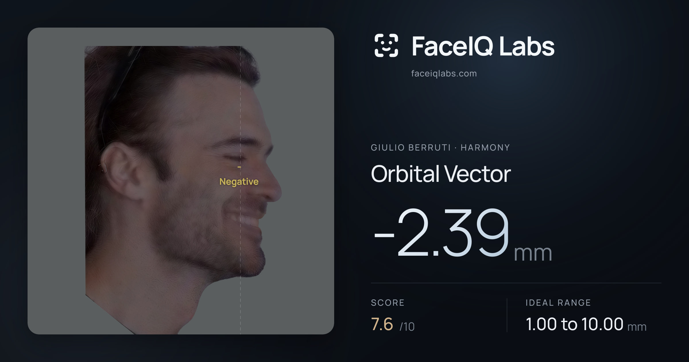 Giulio Berruti Orbital Vector: -2.39mm, drawn on the photo