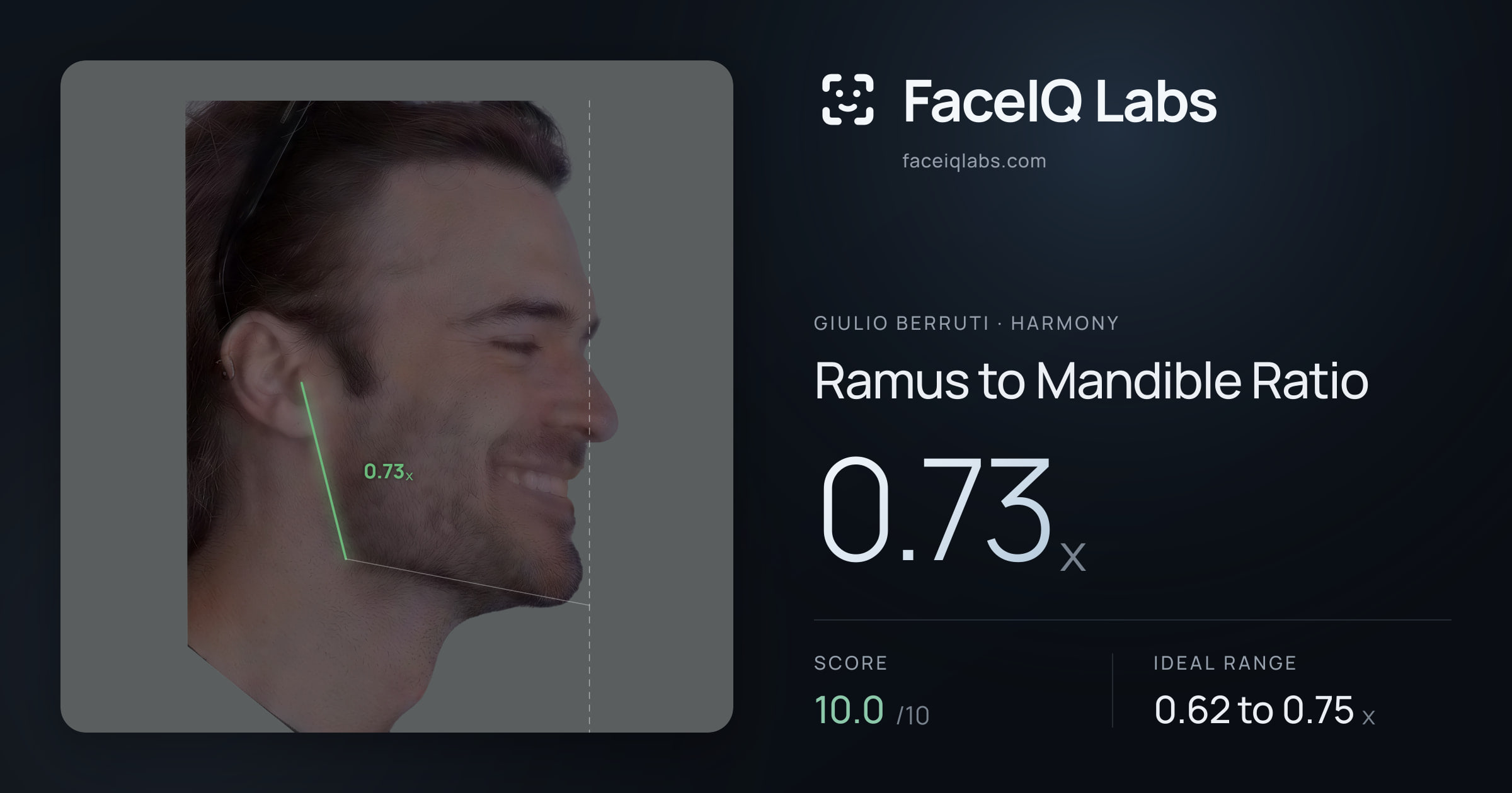 Giulio Berruti Ramus to Mandible Ratio: 0.73x, drawn on the photo