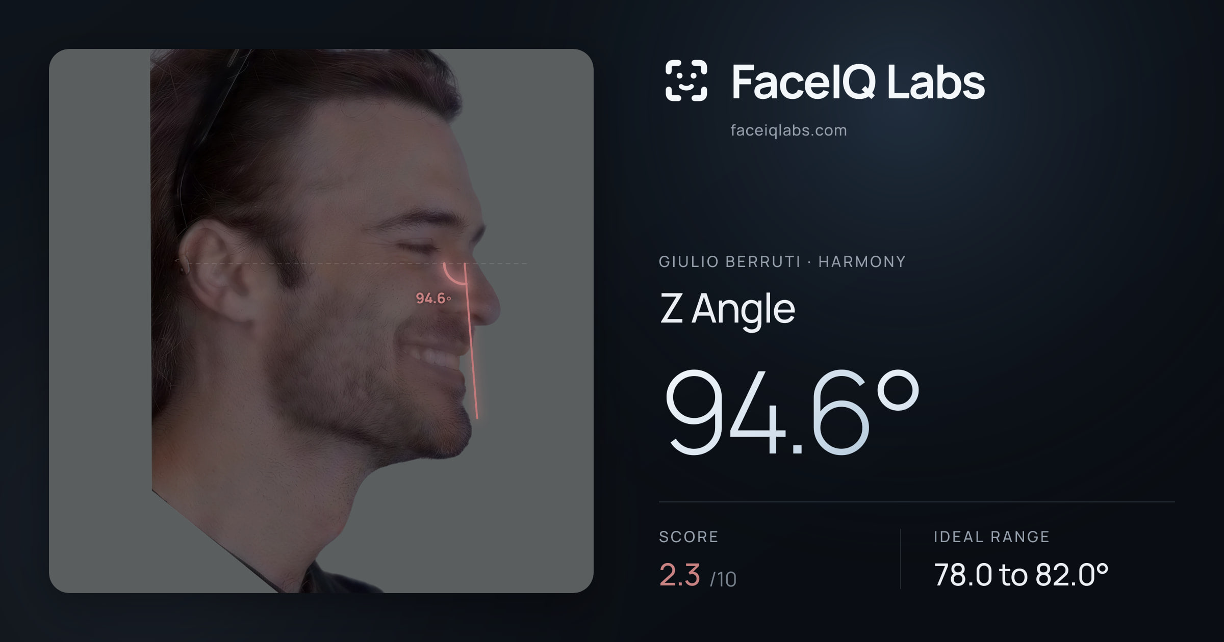 Giulio Berruti Z Angle: 94.6°, drawn on the photo