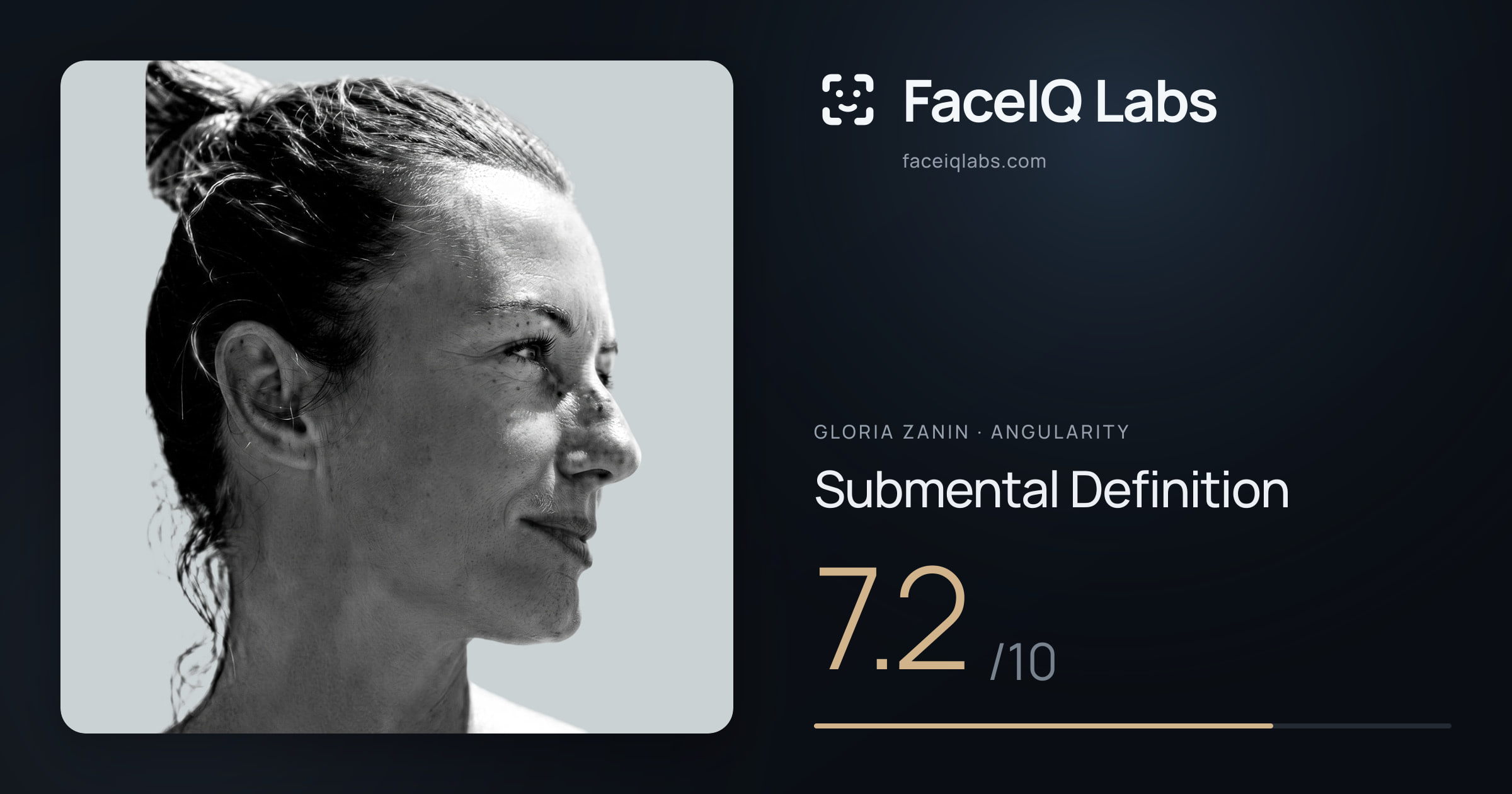 Gloria Zanin Submental Definition: 7.2/10, drawn on the photo