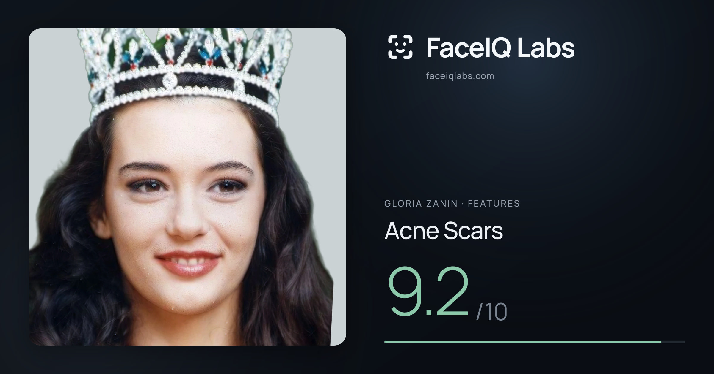 Gloria Zanin Acne Scars: 9.2/10, drawn on the photo