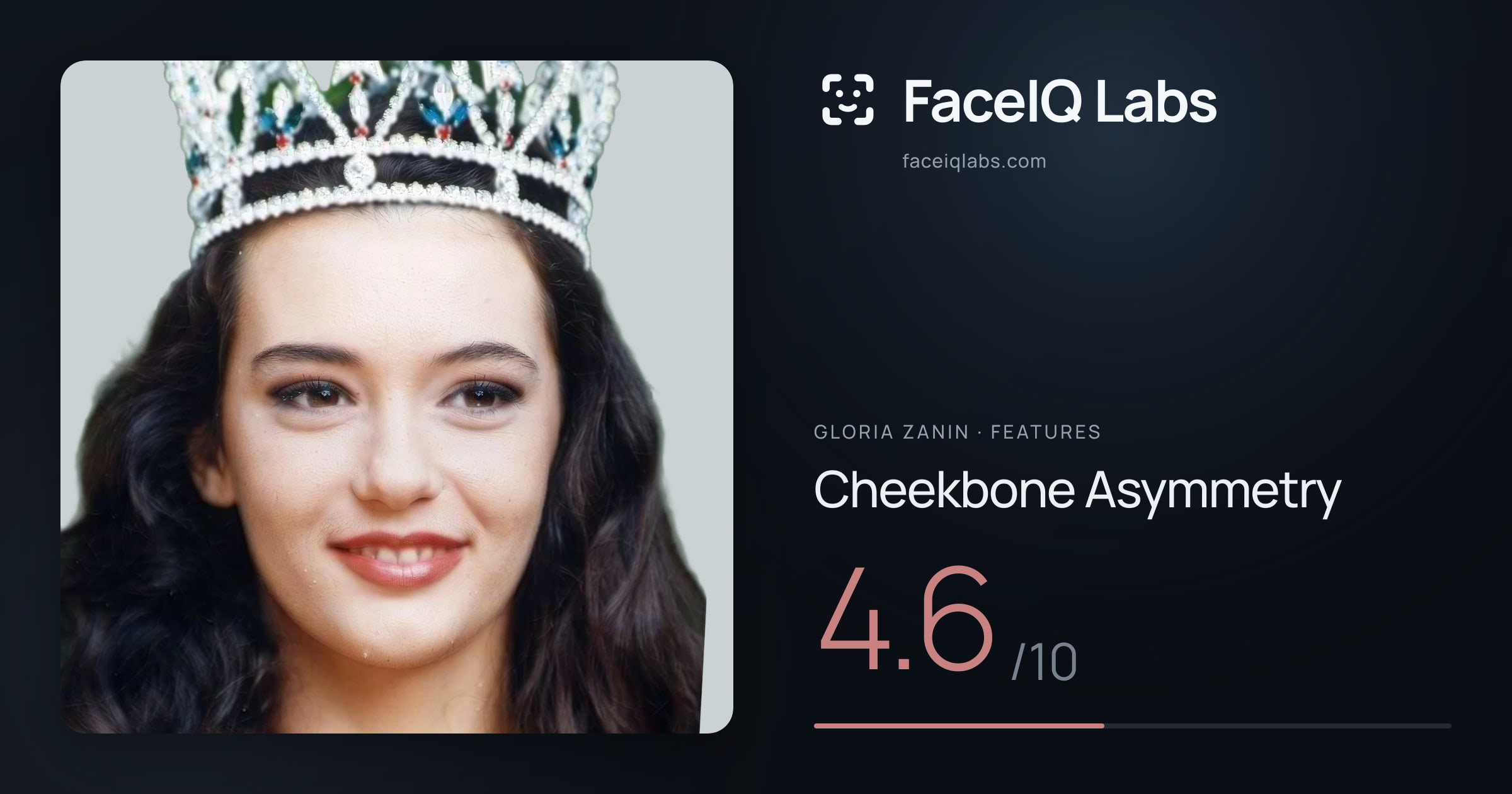 Gloria Zanin Cheekbone Asymmetry: 4.6/10, drawn on the photo