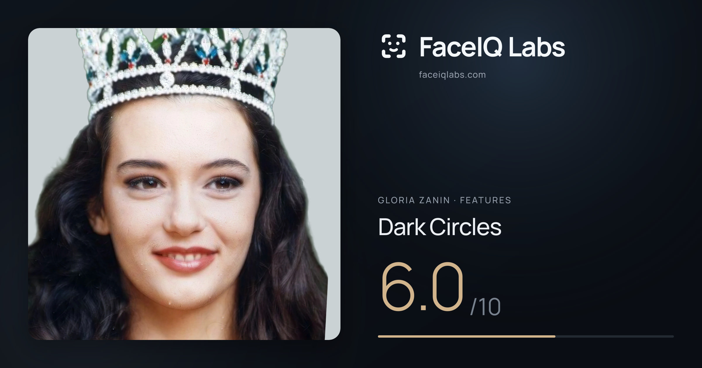 Gloria Zanin Dark Circles: 6.0/10, drawn on the photo