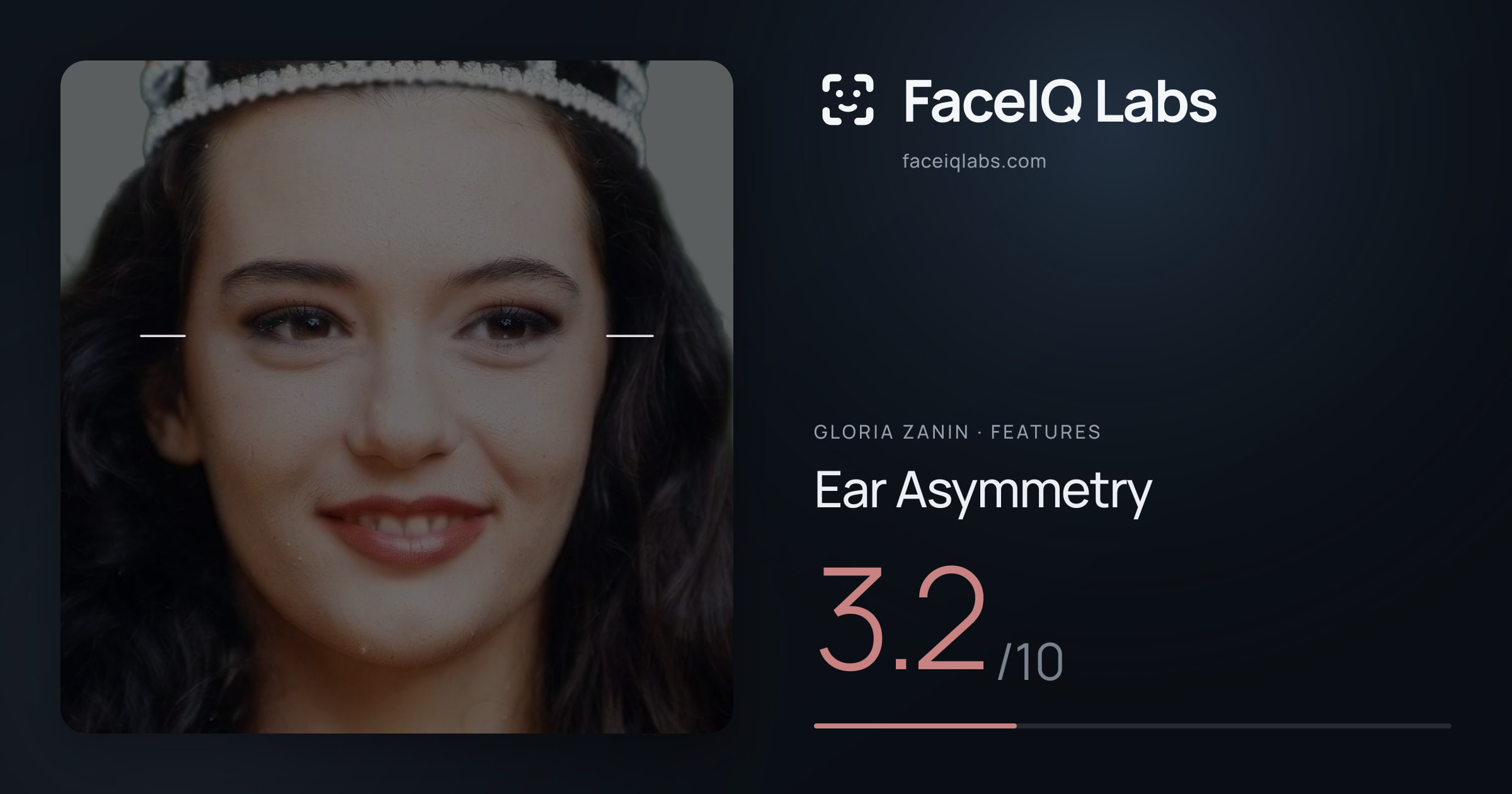 Gloria Zanin Ear Asymmetry: 3.2/10, drawn on the photo