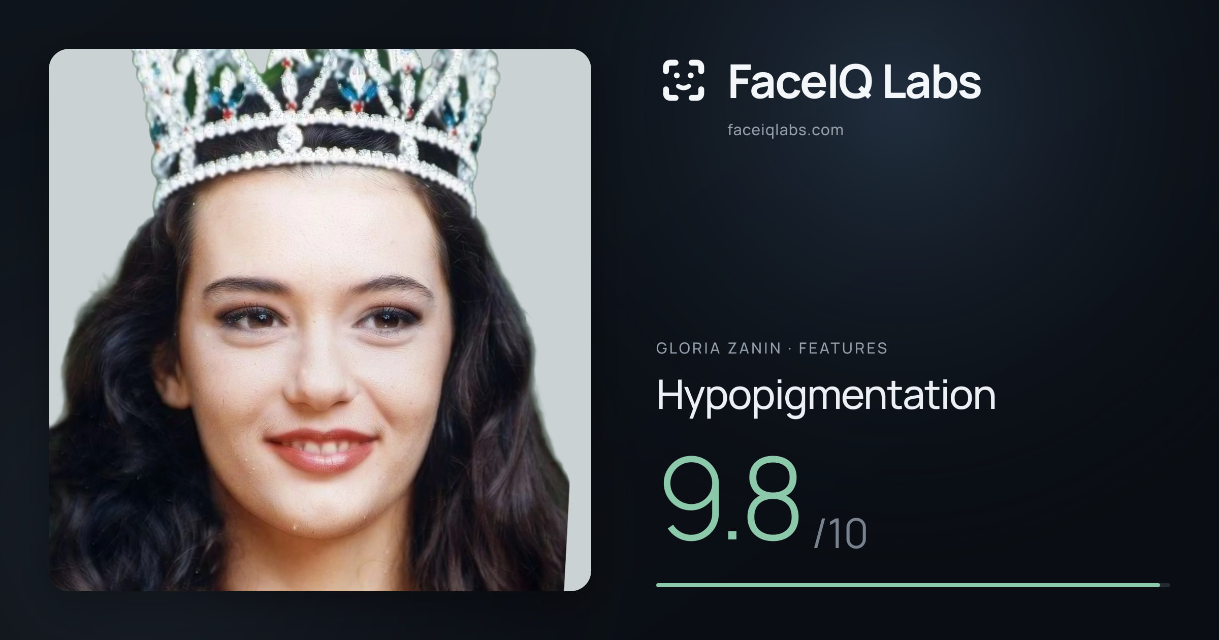 Gloria Zanin Hypopigmentation: 9.8/10, drawn on the photo