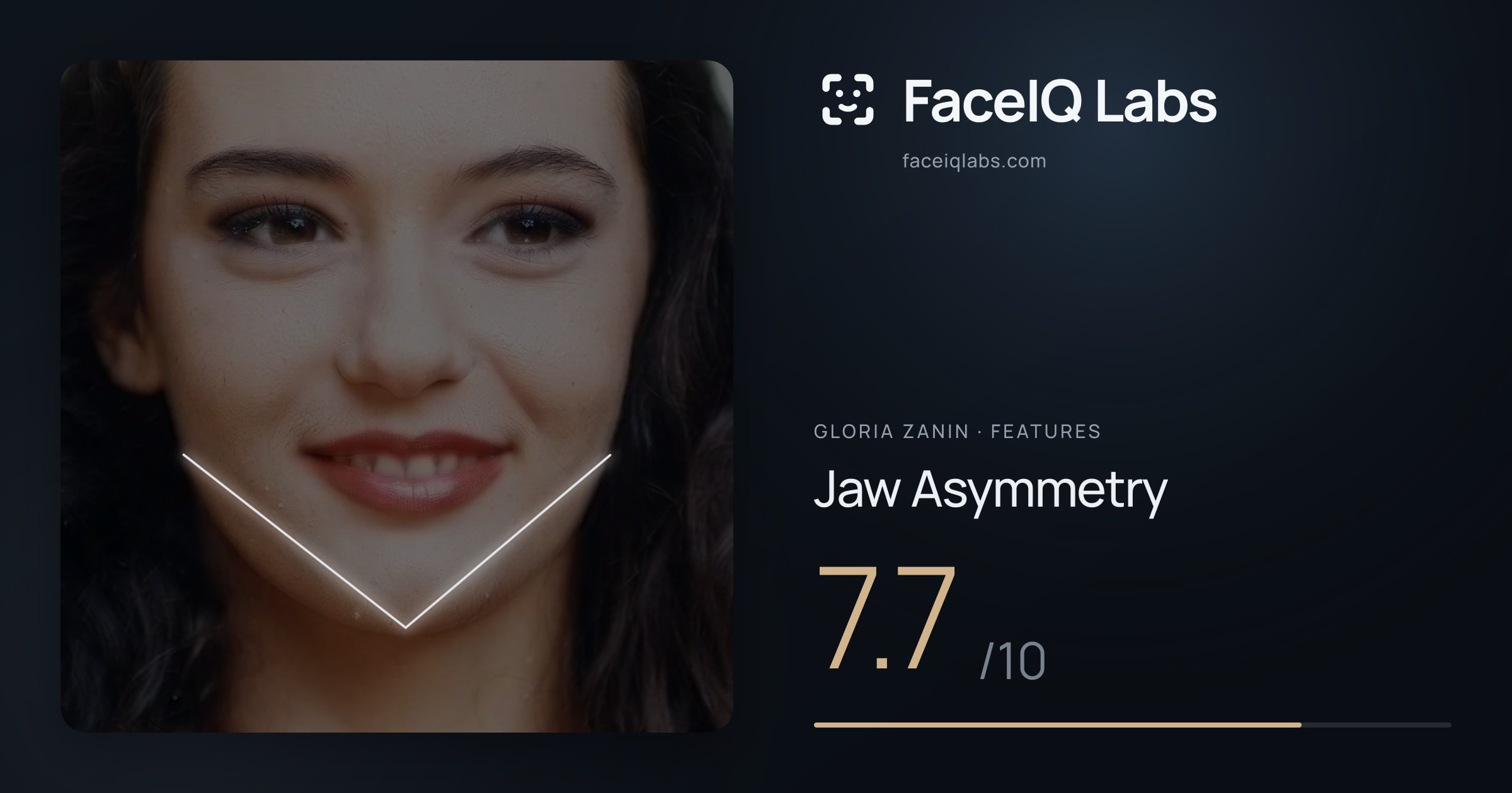 Gloria Zanin Jaw Asymmetry: 7.7/10, drawn on the photo