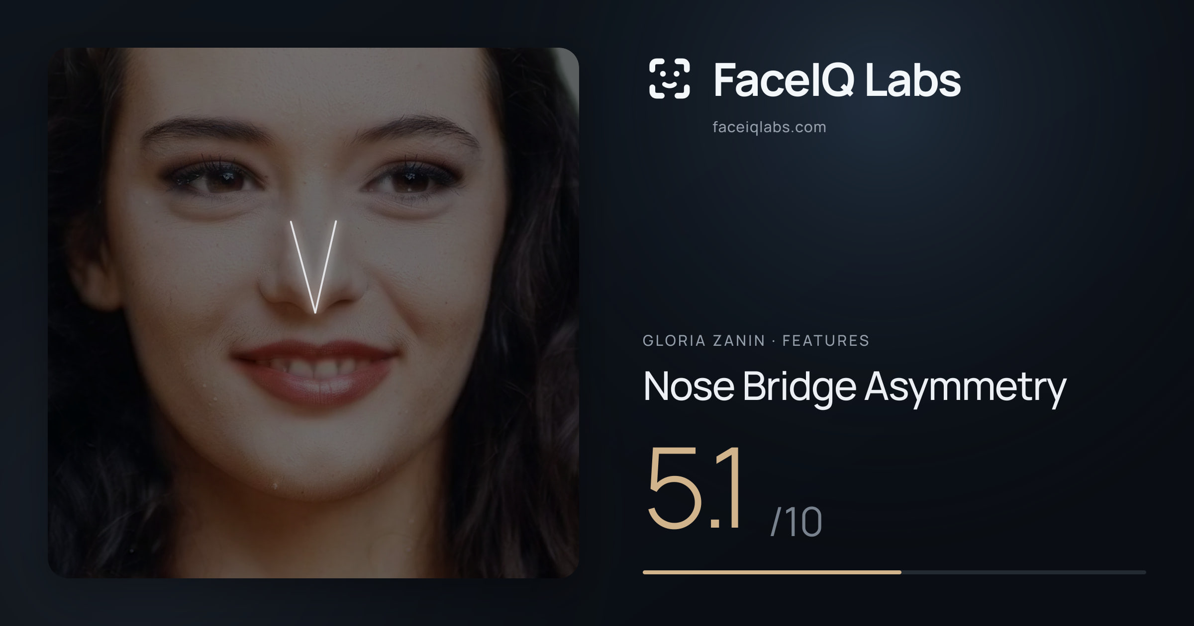 Gloria Zanin Nose Bridge Asymmetry: 5.1/10, drawn on the photo