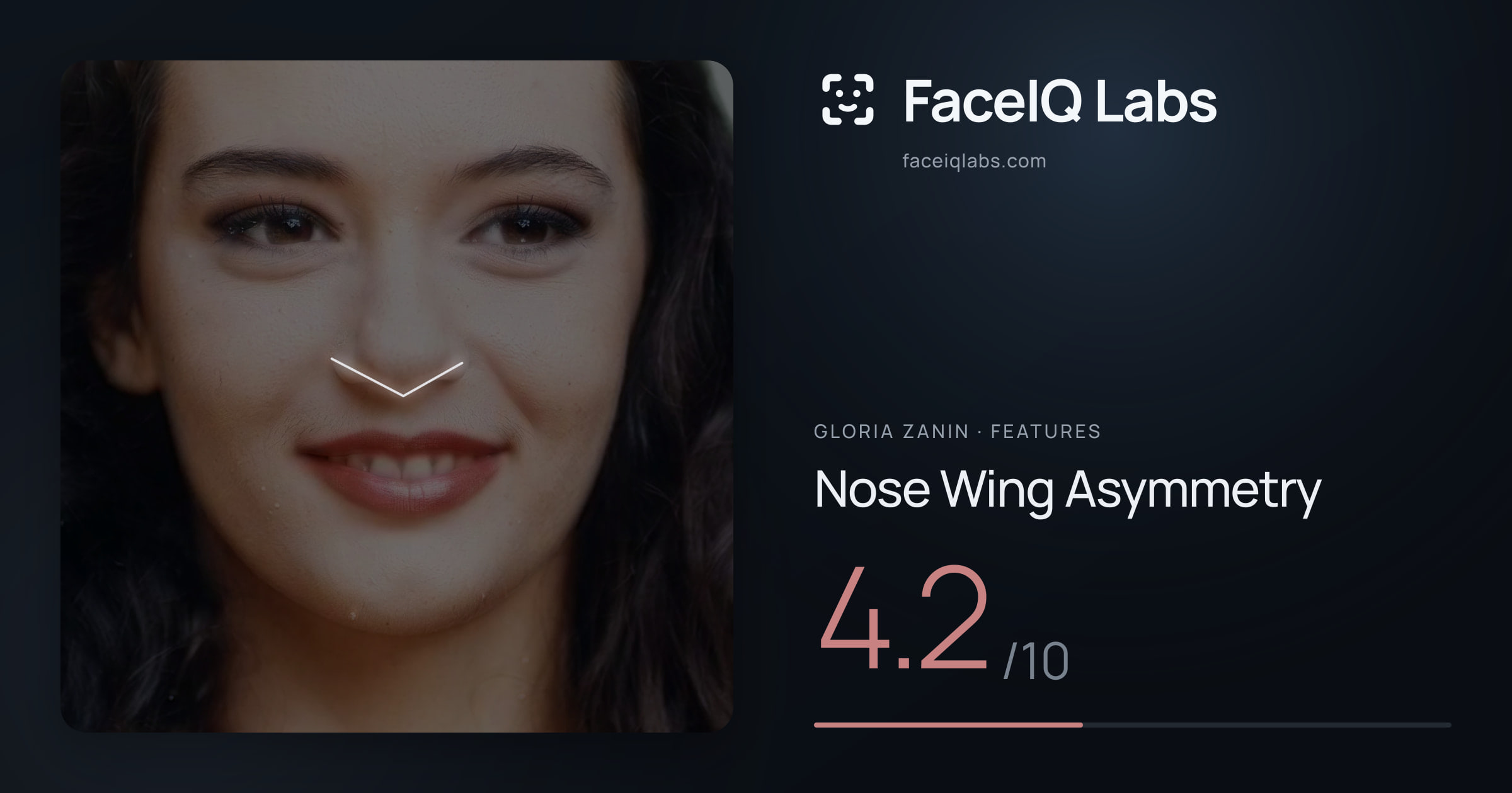 Gloria Zanin Nose Wing Asymmetry: 4.2/10, drawn on the photo