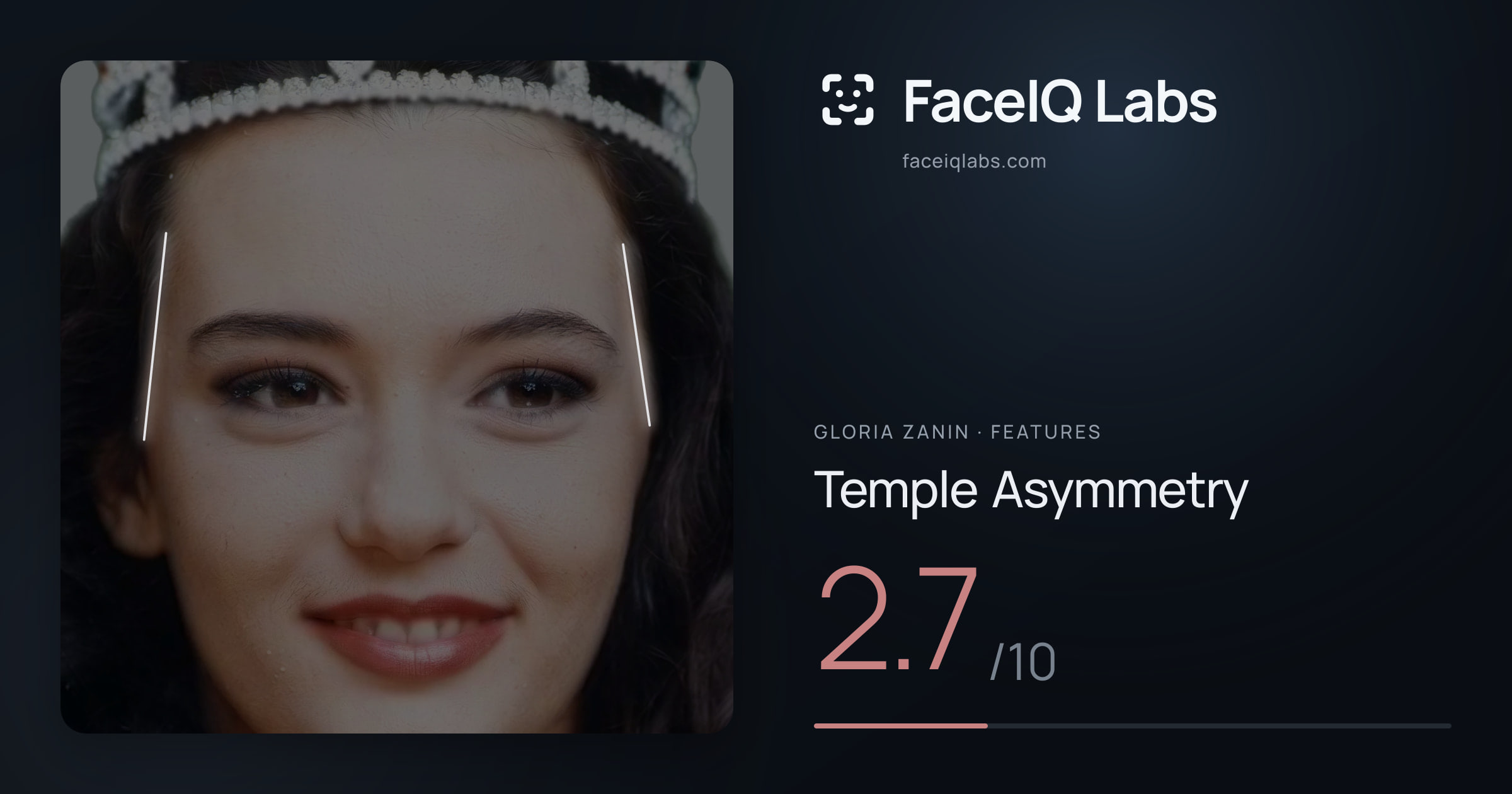 Gloria Zanin Temple Asymmetry: 2.7/10, drawn on the photo
