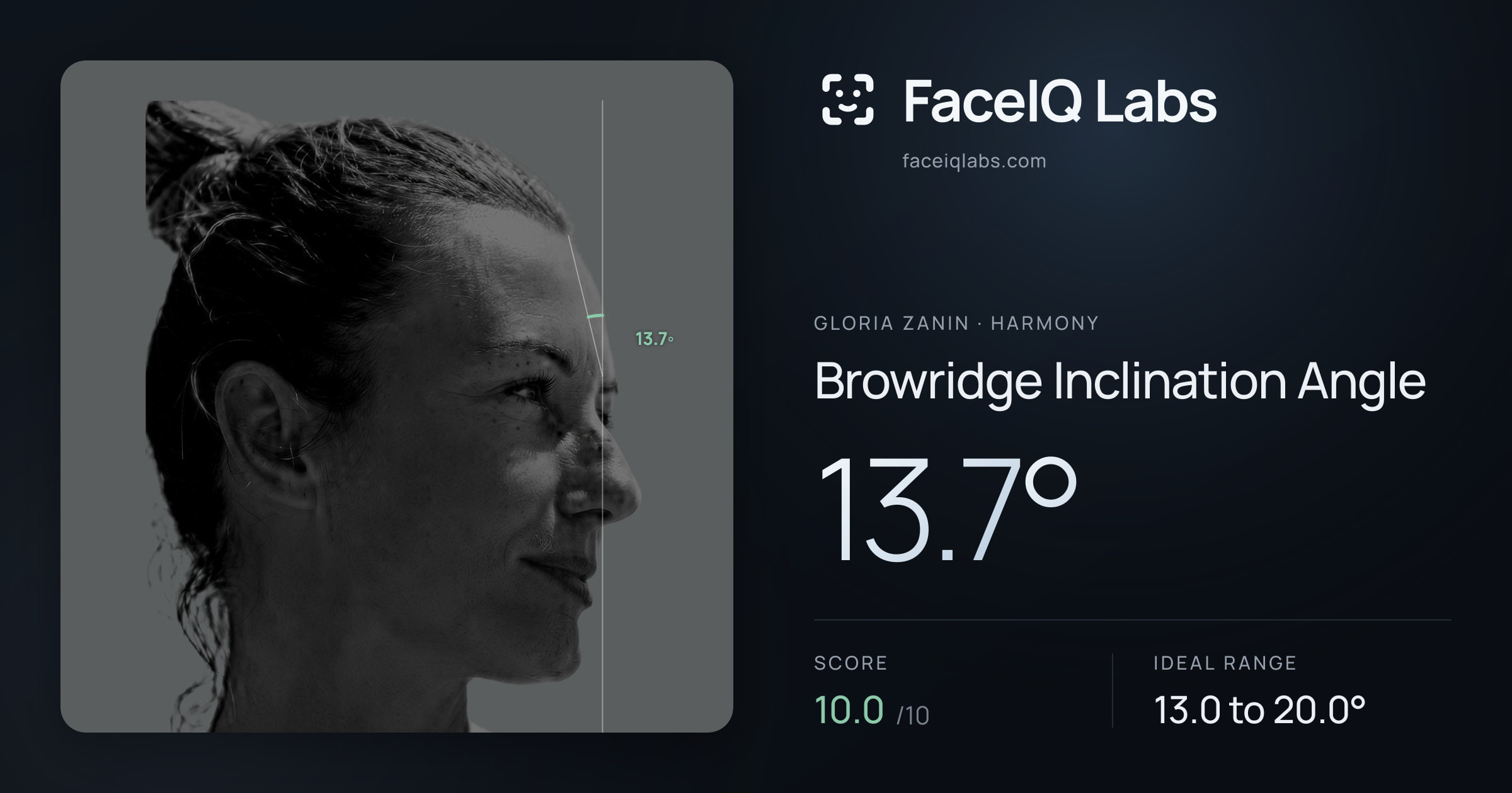 Gloria Zanin Browridge Inclination Angle: 13.7°, drawn on the photo