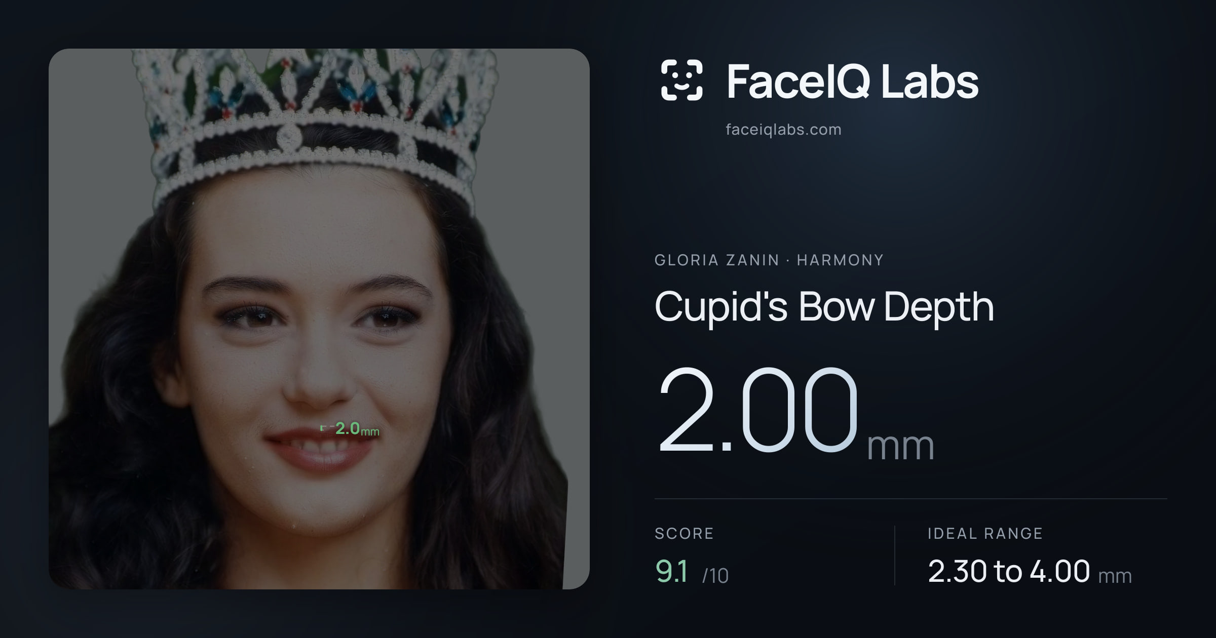 Gloria Zanin Cupid's Bow Depth: 2.00mm, drawn on the photo