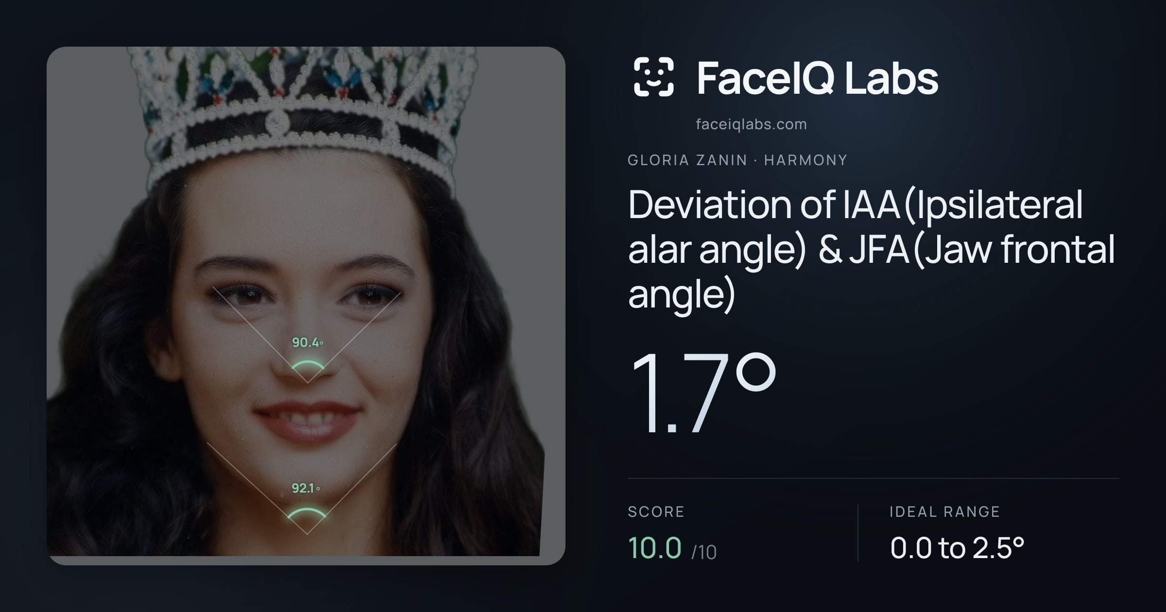 Gloria Zanin Deviation of IAA(Ipsilateral alar angle) & JFA(Jaw frontal angle): 1.7°, drawn on the photo