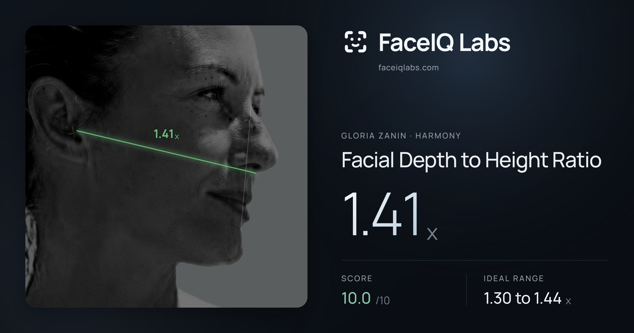 Gloria Zanin Facial Depth to Height Ratio: 1.41x, drawn on the photo