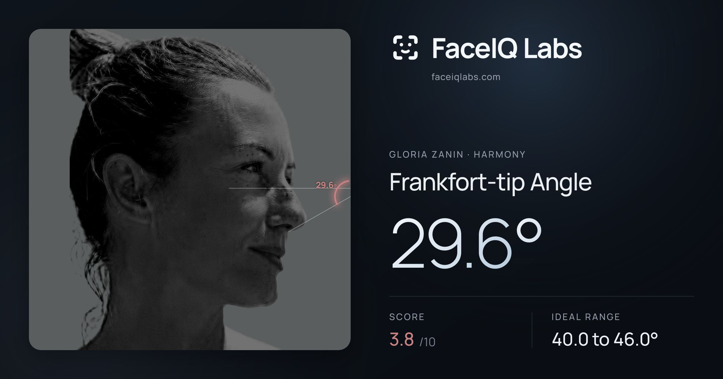 Gloria Zanin Frankfort-tip Angle: 29.6°, drawn on the photo