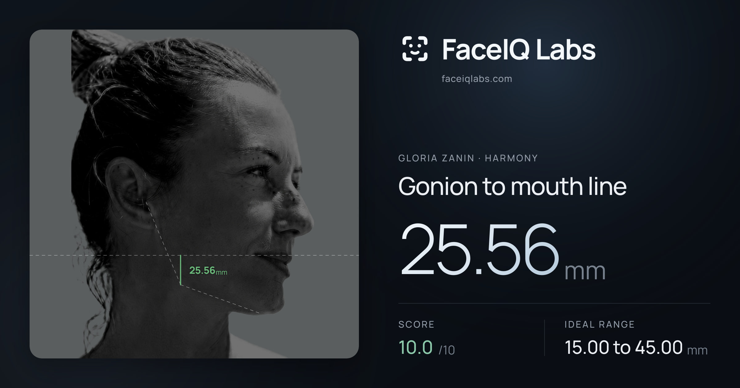 Gloria Zanin Gonion to mouth line: 25.56mm, drawn on the photo