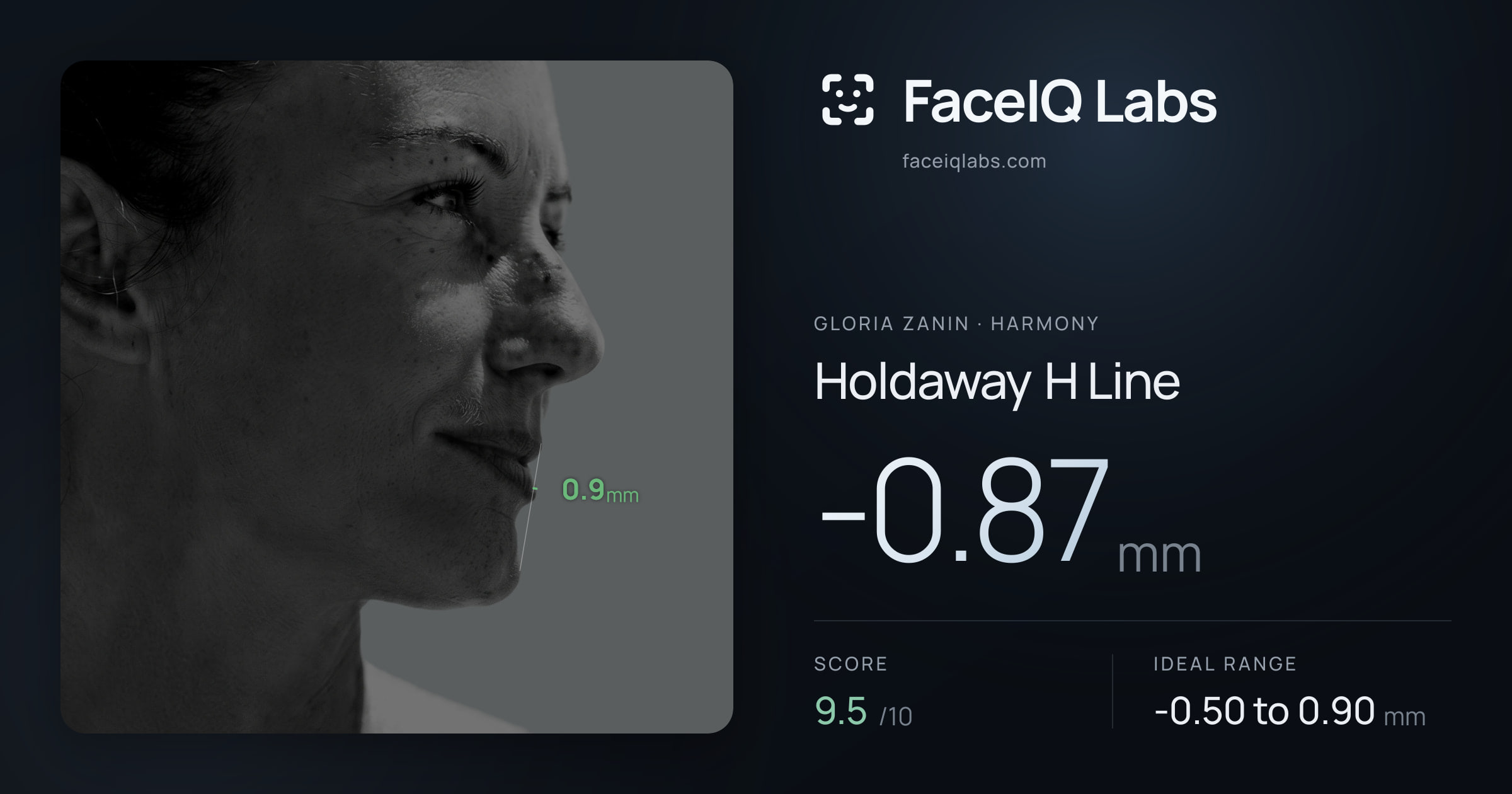 Gloria Zanin Holdaway H Line: -0.87mm, drawn on the photo