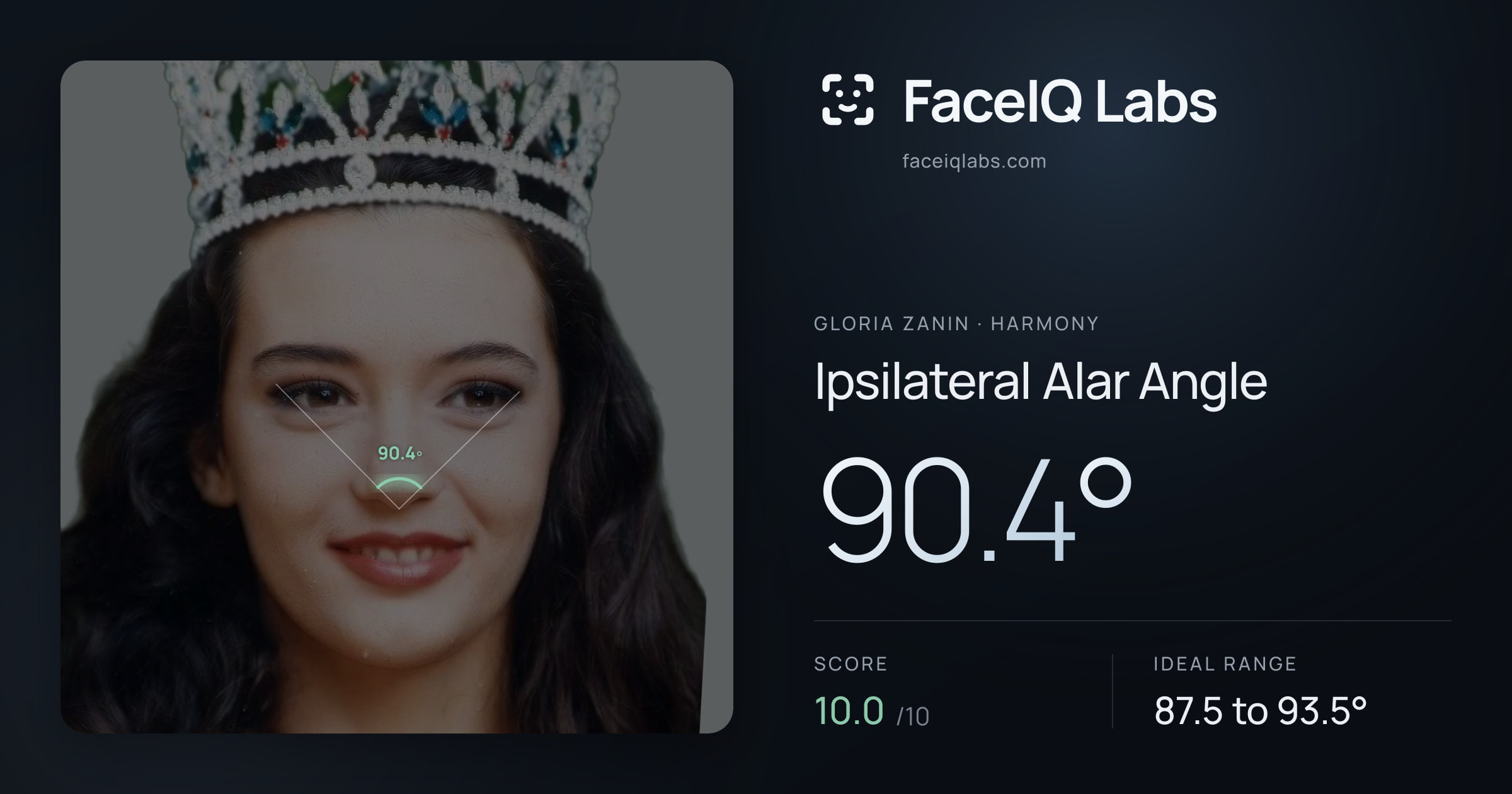 Gloria Zanin Ipsilateral Alar Angle: 90.4°, drawn on the photo