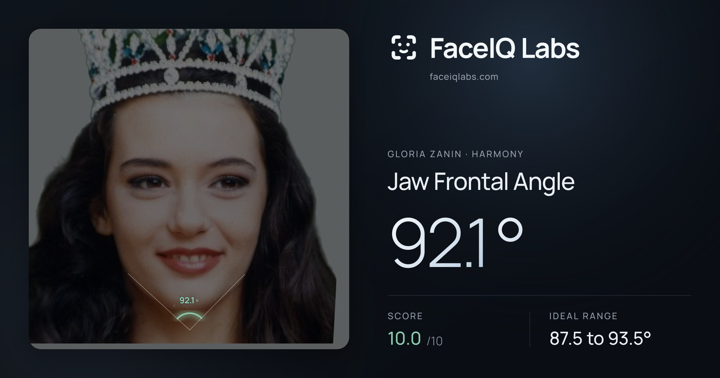 Gloria Zanin Jaw Frontal Angle: 92.1°, drawn on the photo