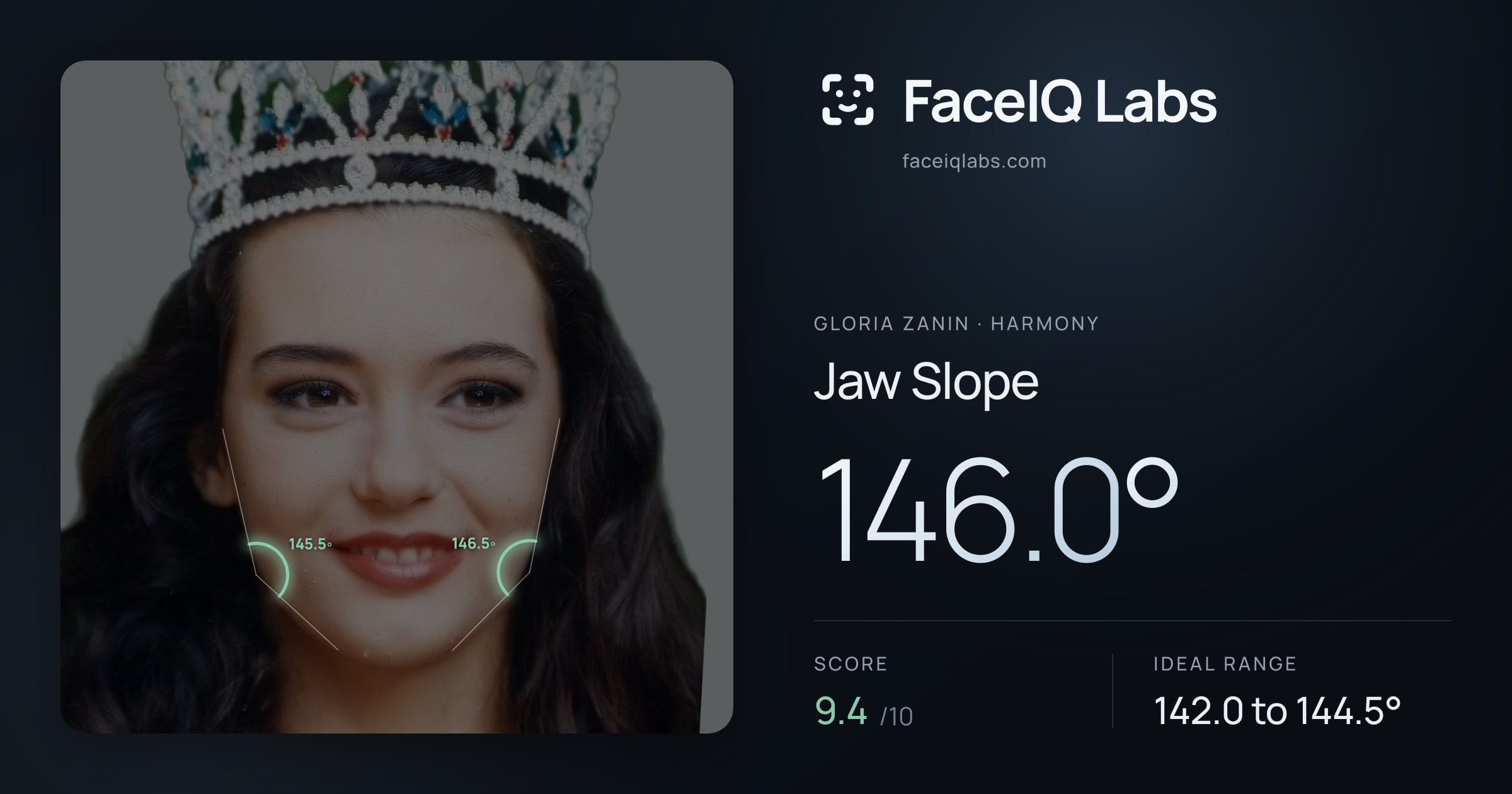 Gloria Zanin Jaw Slope: 146.0°, drawn on the photo