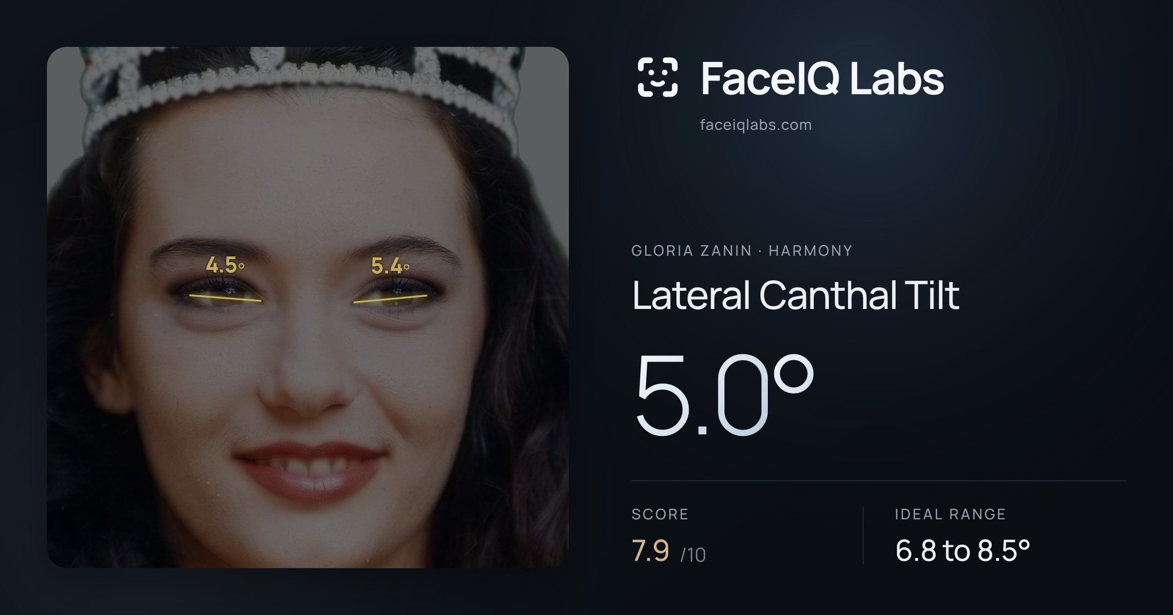 Gloria Zanin Lateral Canthal Tilt: 5.0°, drawn on the photo