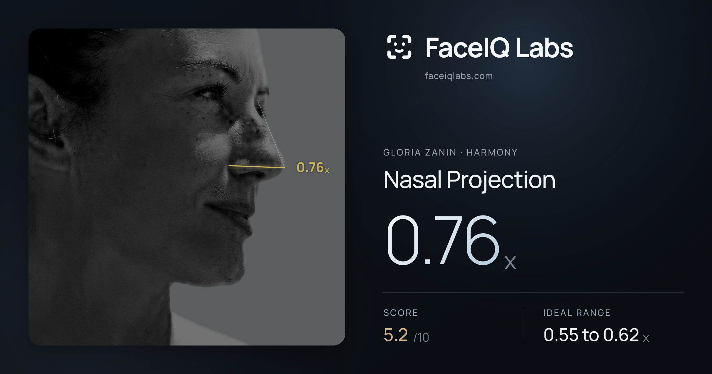 Gloria Zanin Nasal Projection: 0.76x, drawn on the photo