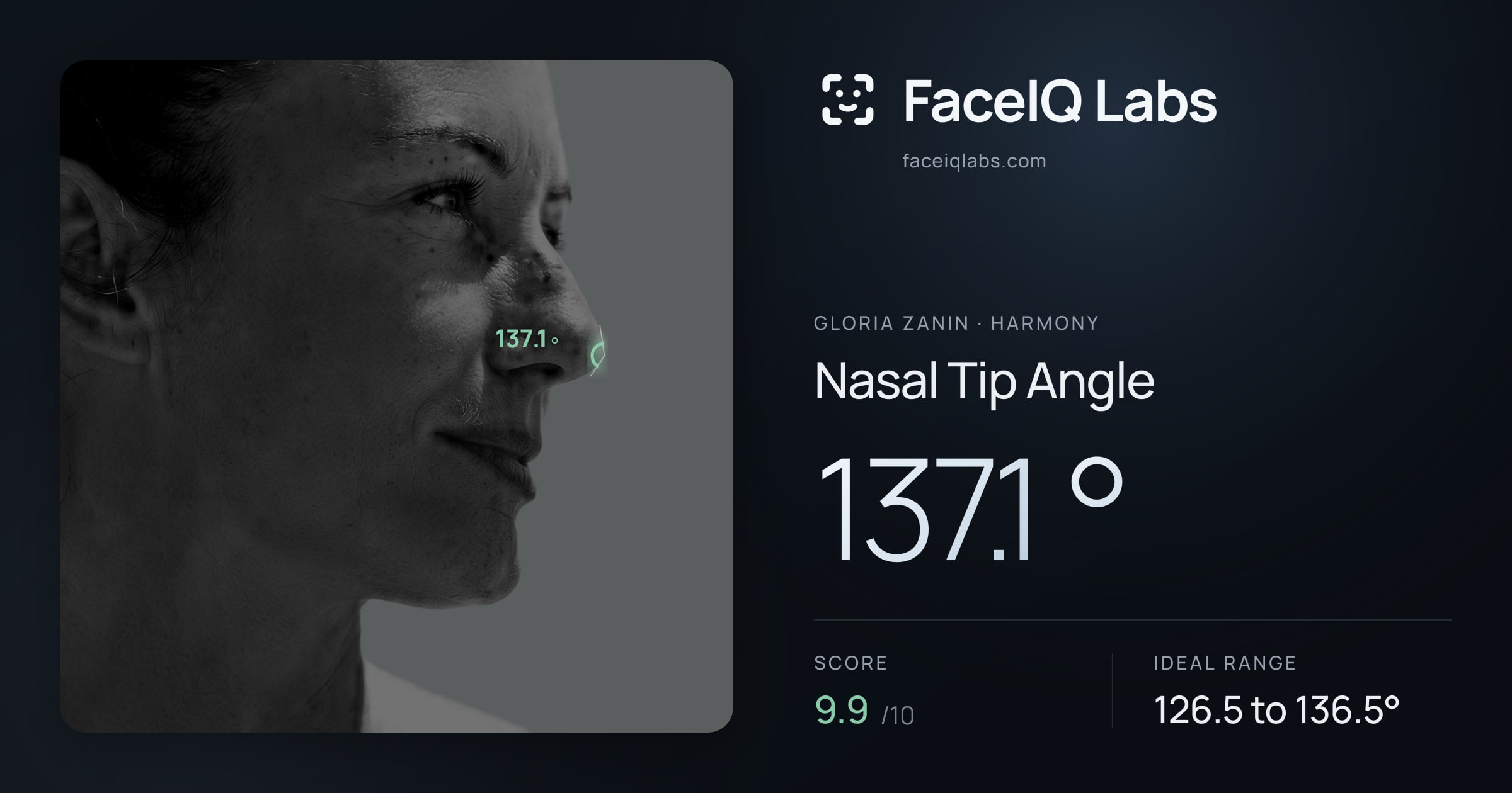 Gloria Zanin Nasal Tip Angle: 137.1°, drawn on the photo