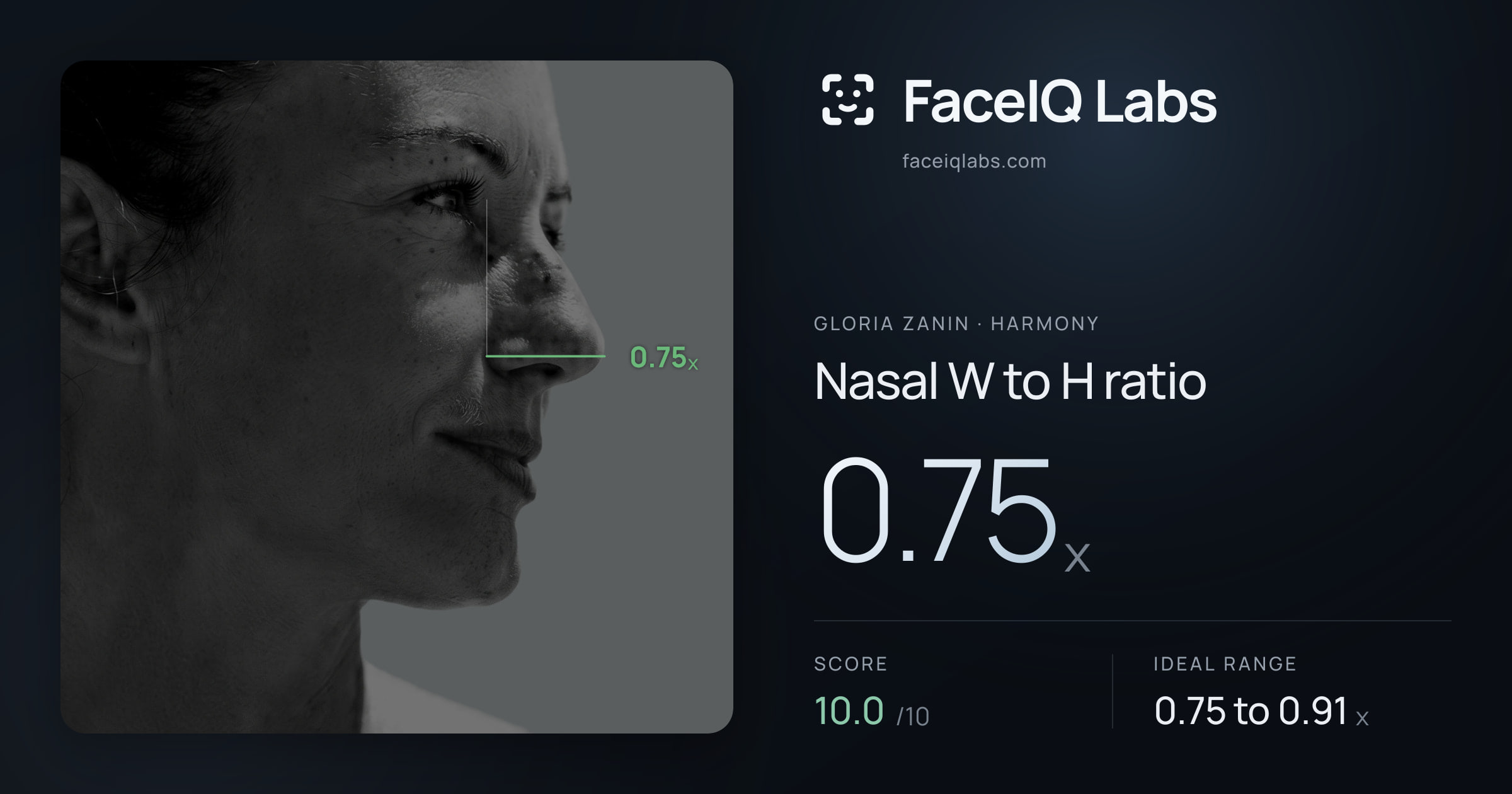 Gloria Zanin Nasal W to H ratio: 0.75x, drawn on the photo