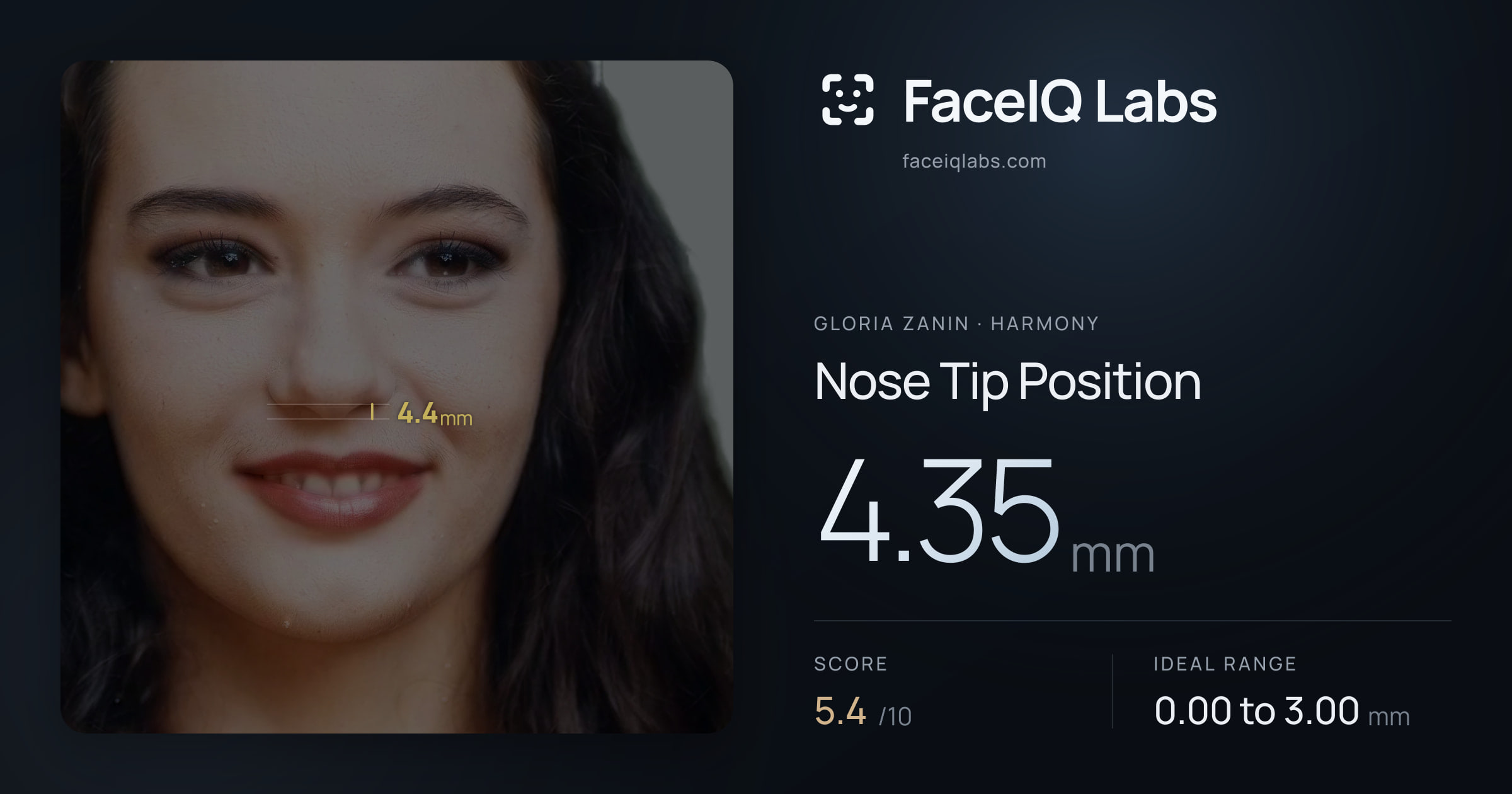 Gloria Zanin Nose Tip Position: 4.35mm, drawn on the photo