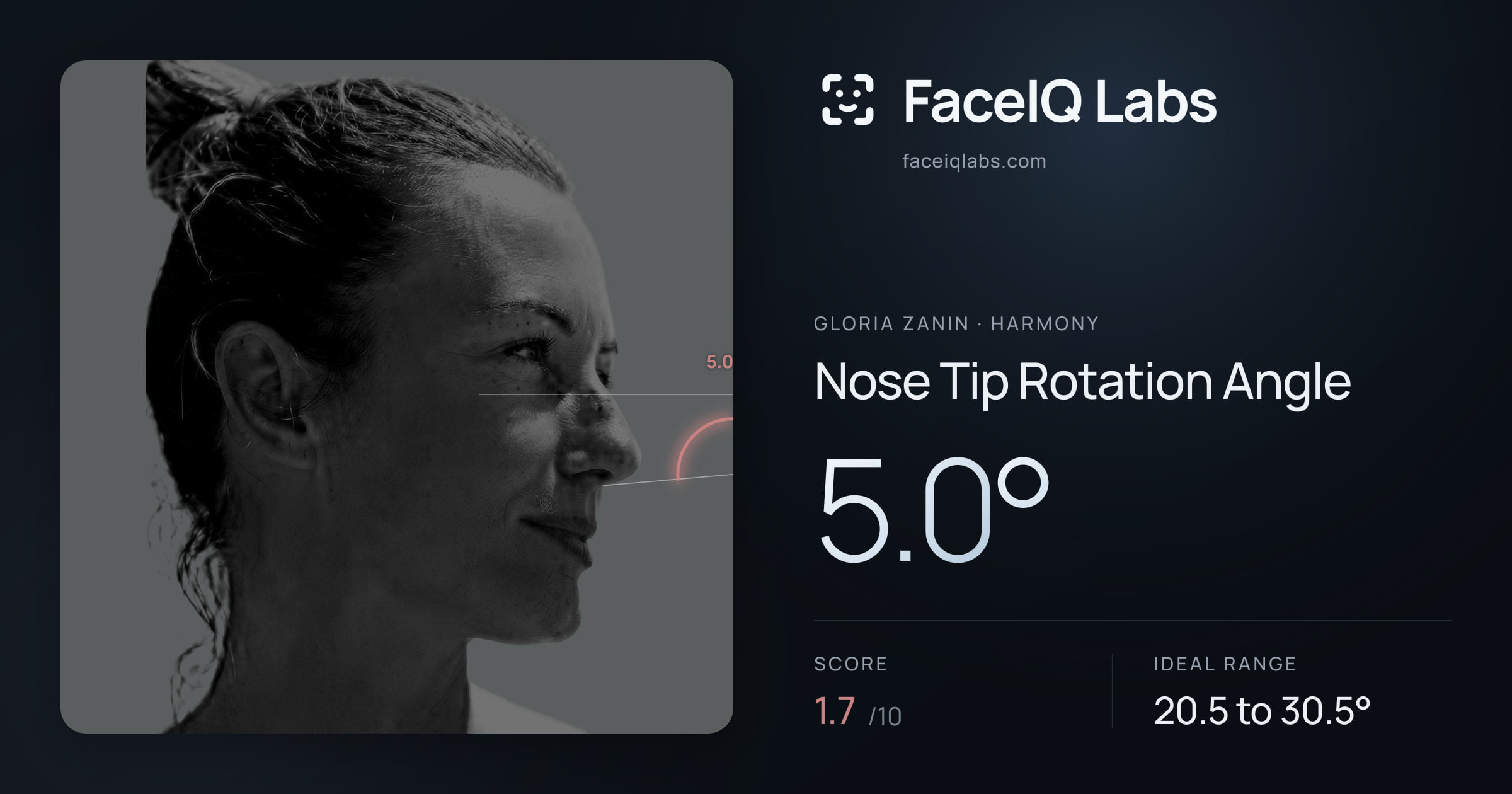 Gloria Zanin Nose Tip Rotation Angle: 5.0°, drawn on the photo
