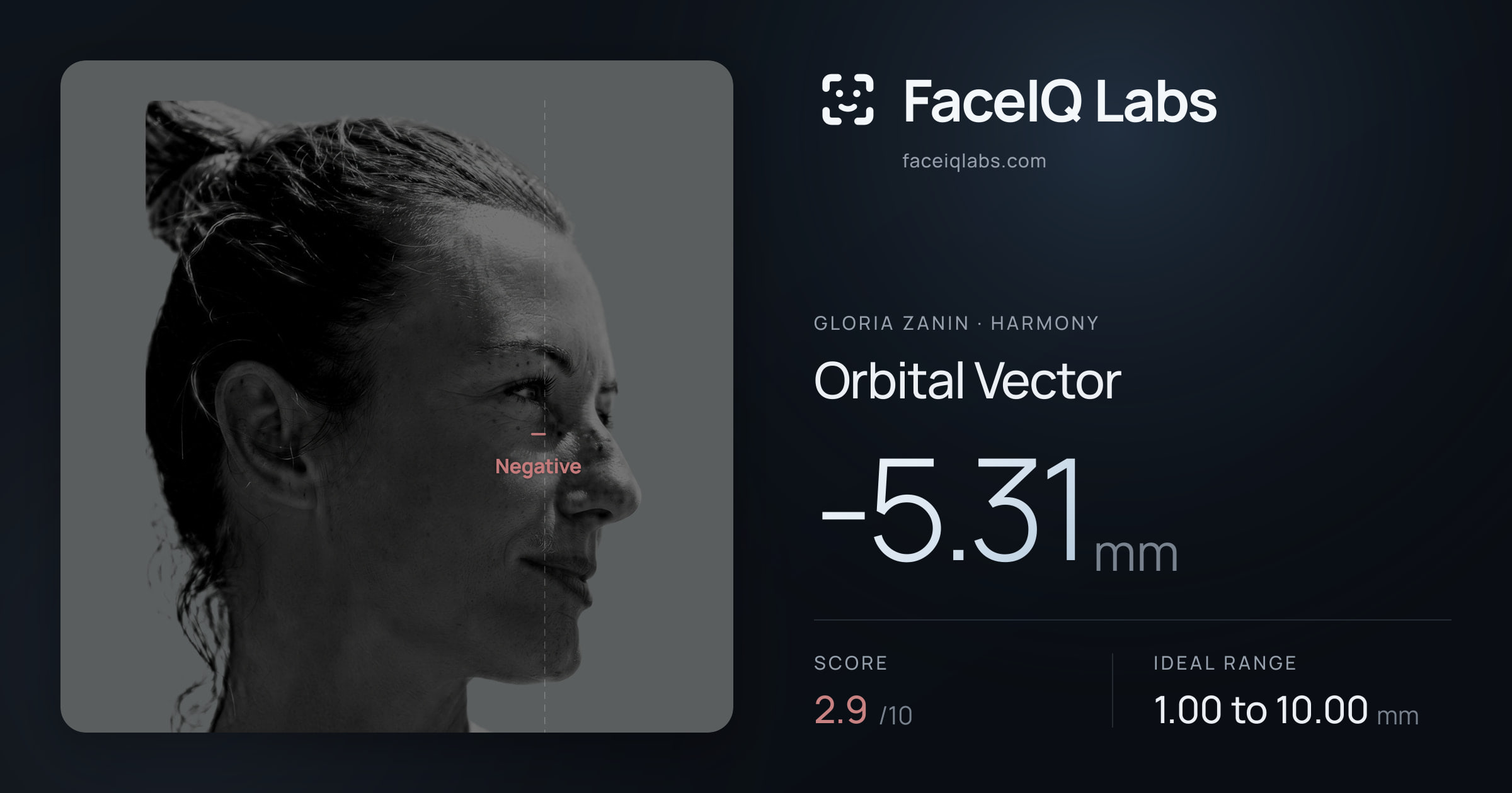 Gloria Zanin Orbital Vector: -5.31mm, drawn on the photo