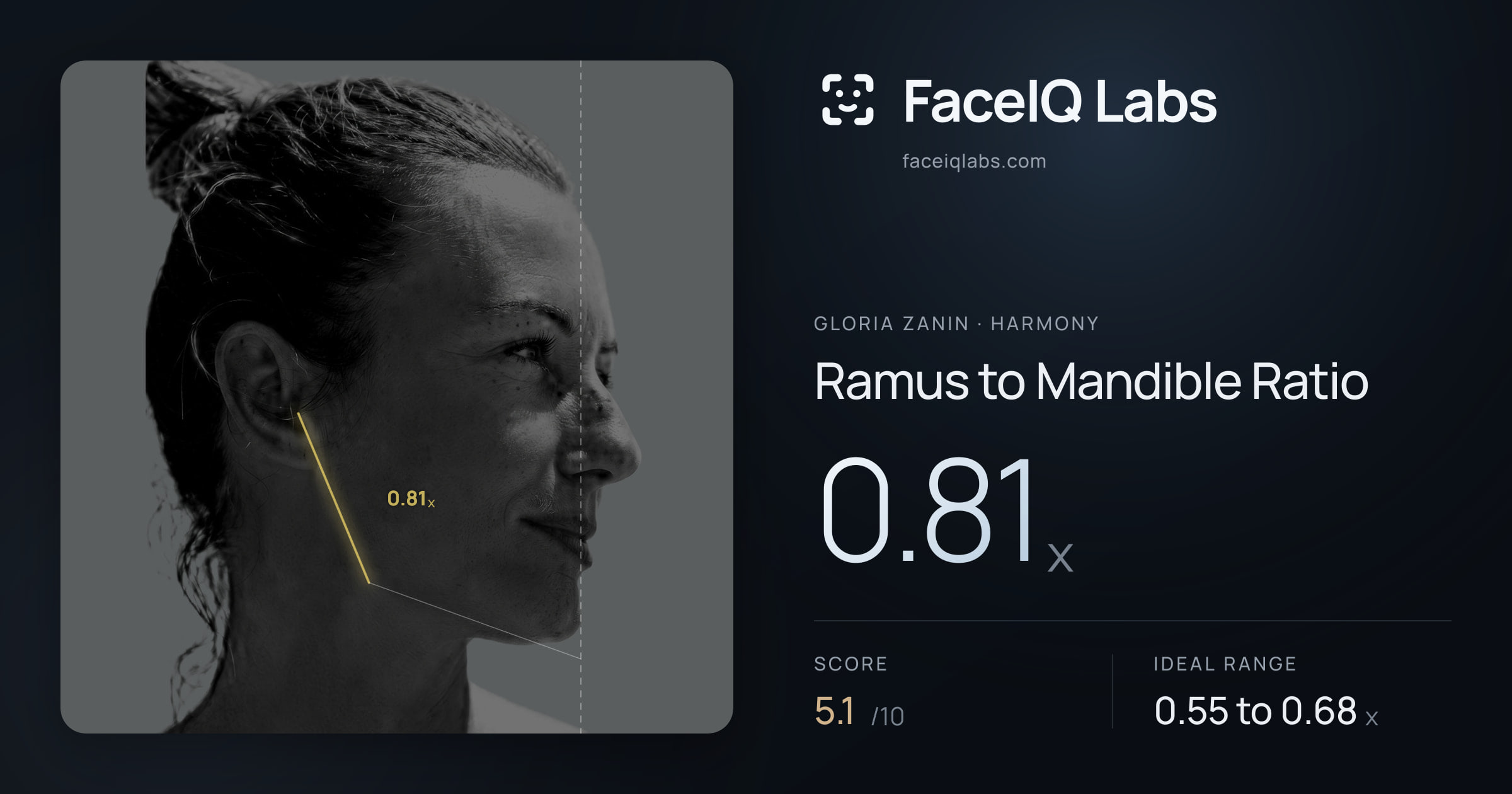 Gloria Zanin Ramus to Mandible Ratio: 0.81x, drawn on the photo