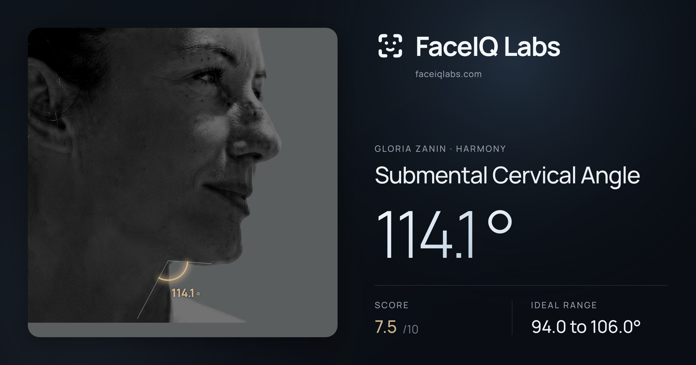 Gloria Zanin Submental Cervical Angle: 114.1°, drawn on the photo
