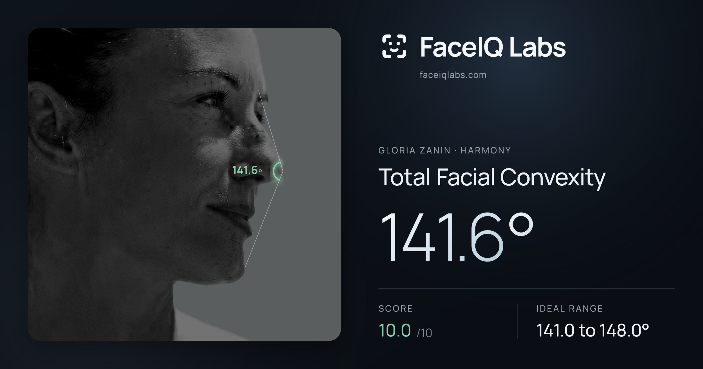 Gloria Zanin Total Facial Convexity: 141.6°, drawn on the photo