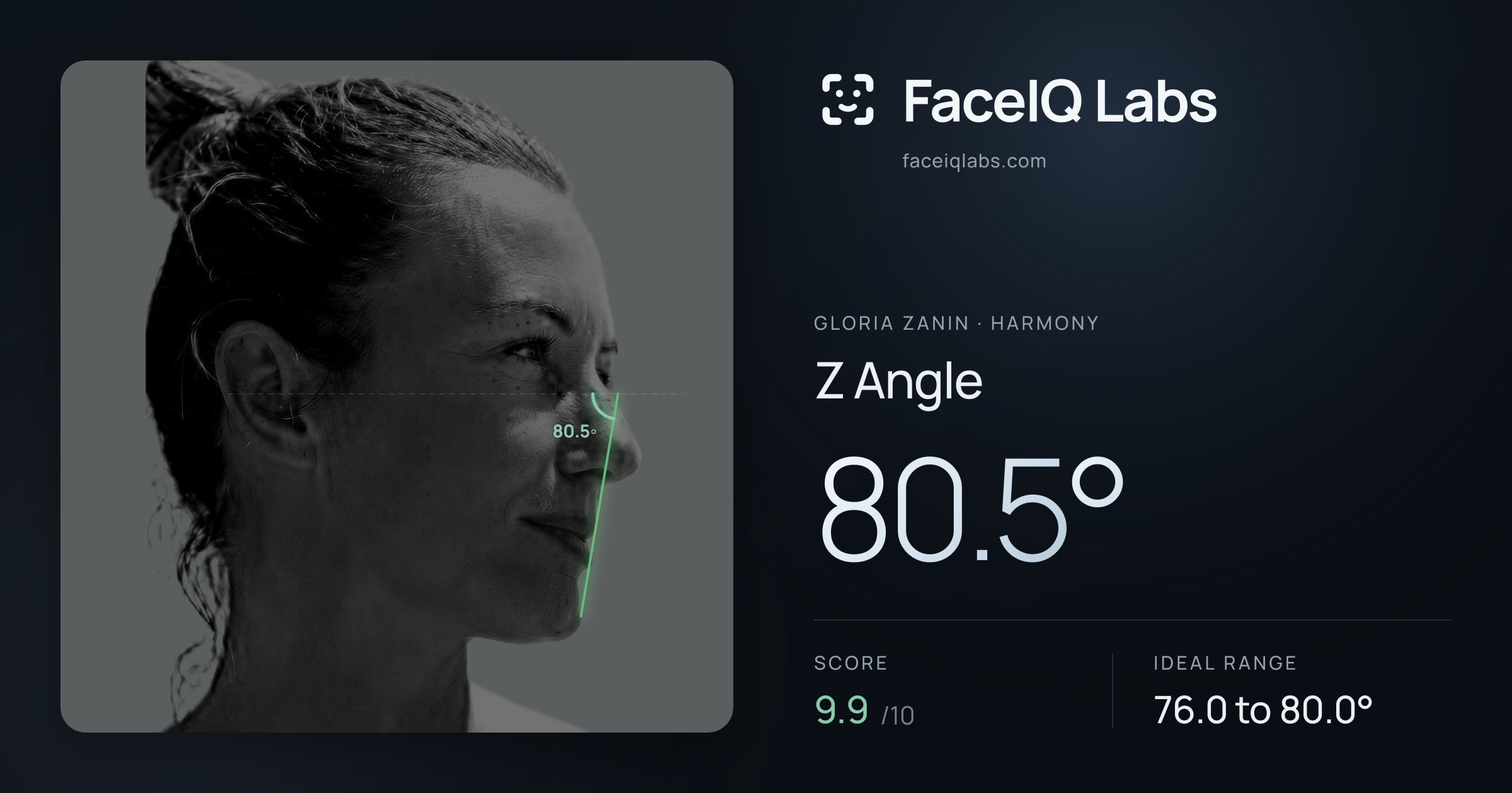 Gloria Zanin Z Angle: 80.5°, drawn on the photo