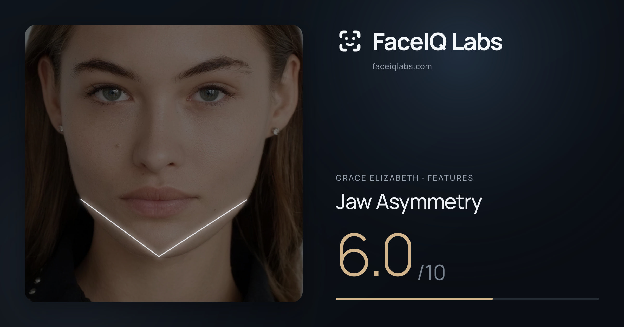 Grace Elizabeth Jaw Asymmetry: 6.0/10, drawn on the photo