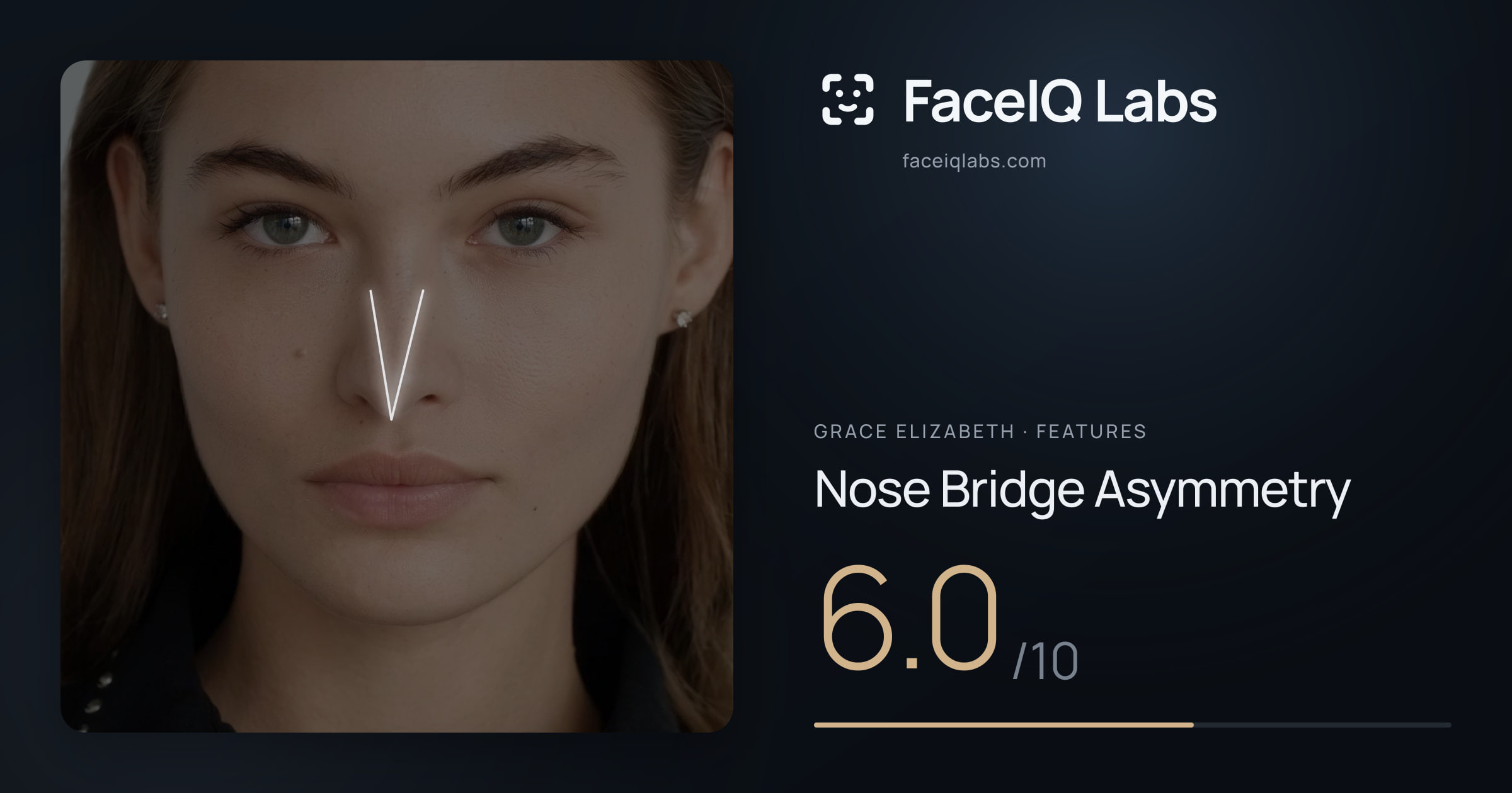 Grace Elizabeth Nose Bridge Asymmetry: 6.0/10, drawn on the photo