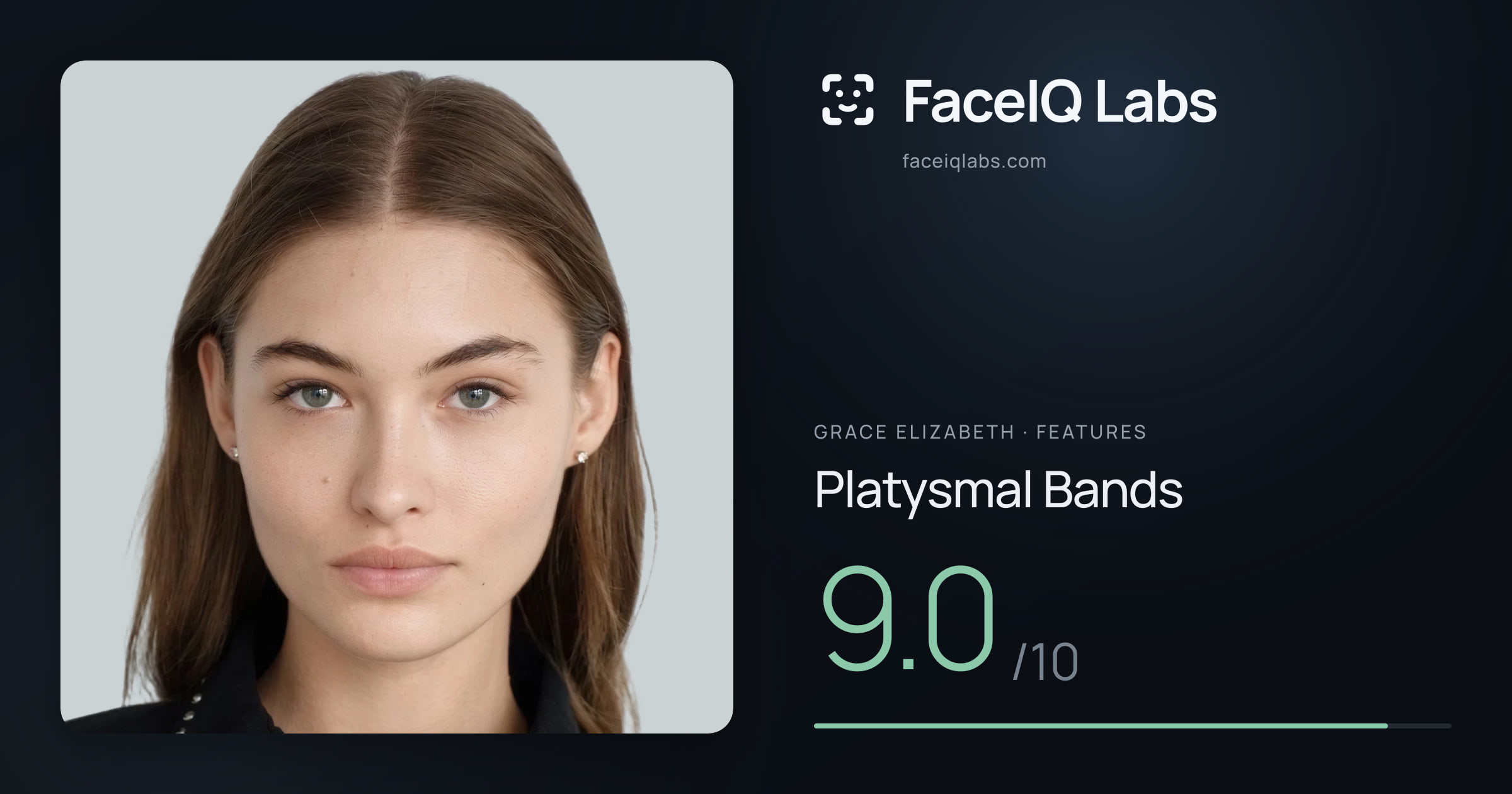 Grace Elizabeth Platysmal Bands: 9.0/10, drawn on the photo