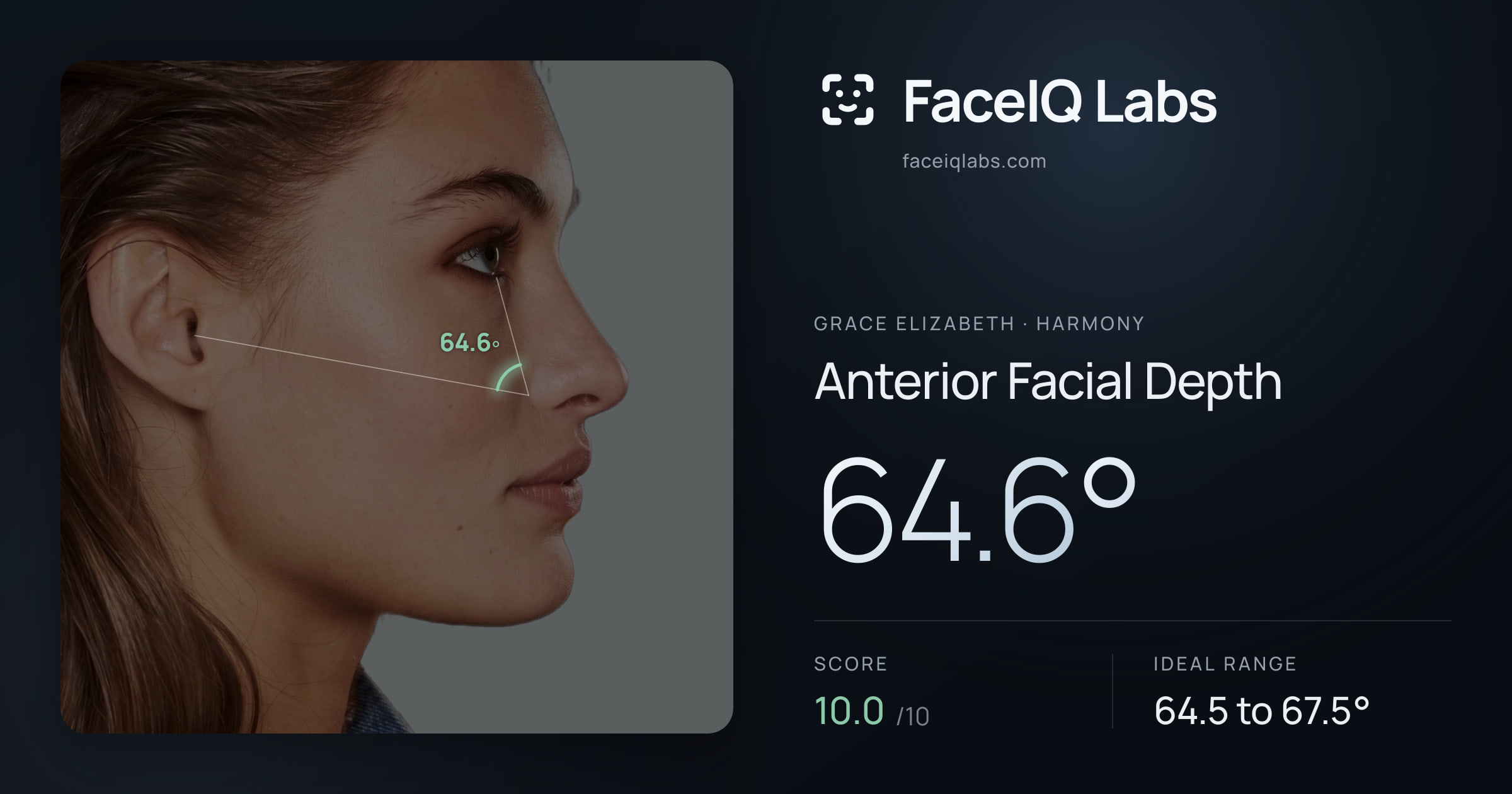 Grace Elizabeth Anterior Facial Depth: 64.6°, drawn on the photo