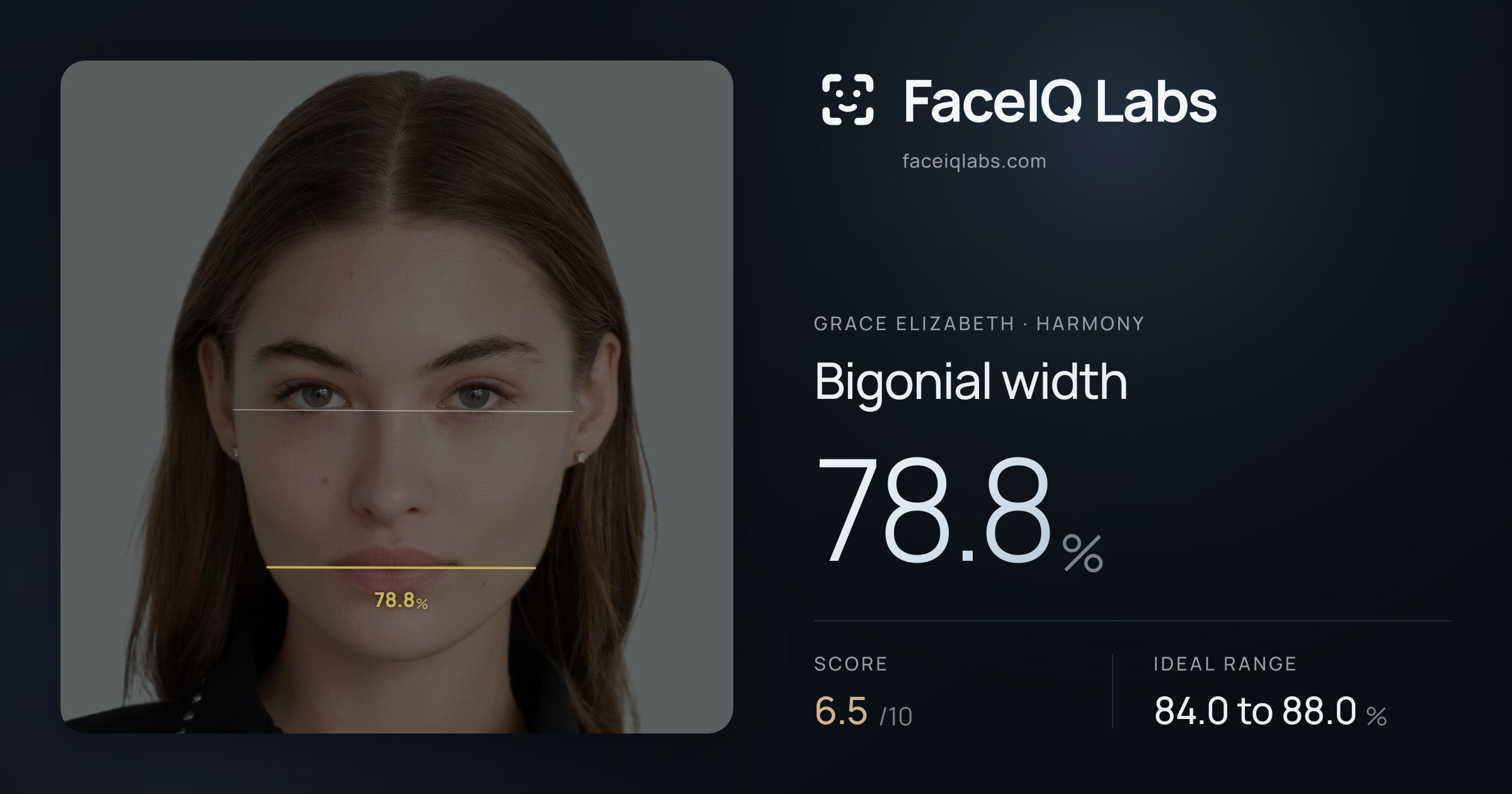 Grace Elizabeth Bigonial width: 78.8%, drawn on the photo