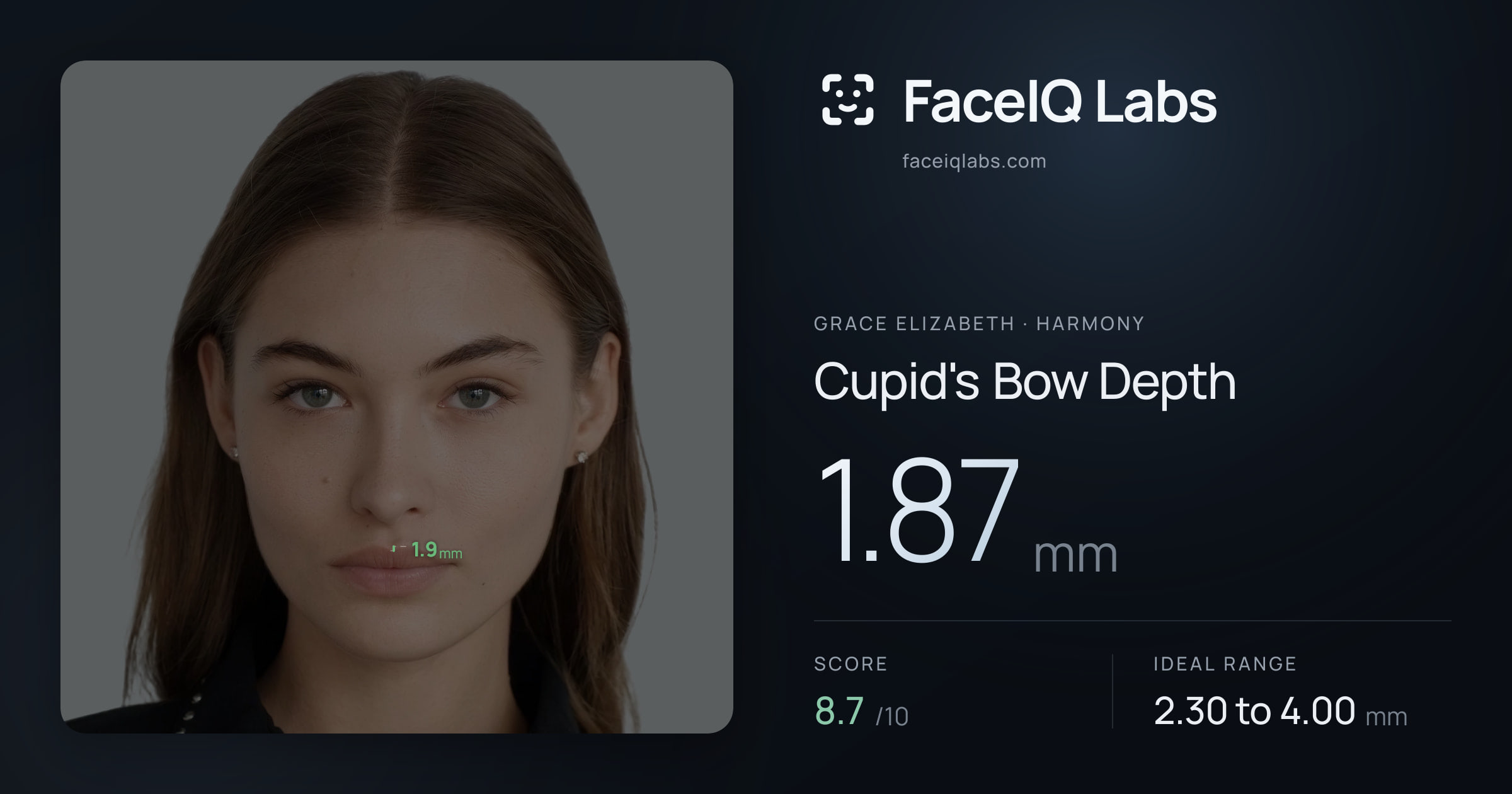 Grace Elizabeth Cupid's Bow Depth: 1.87mm, drawn on the photo