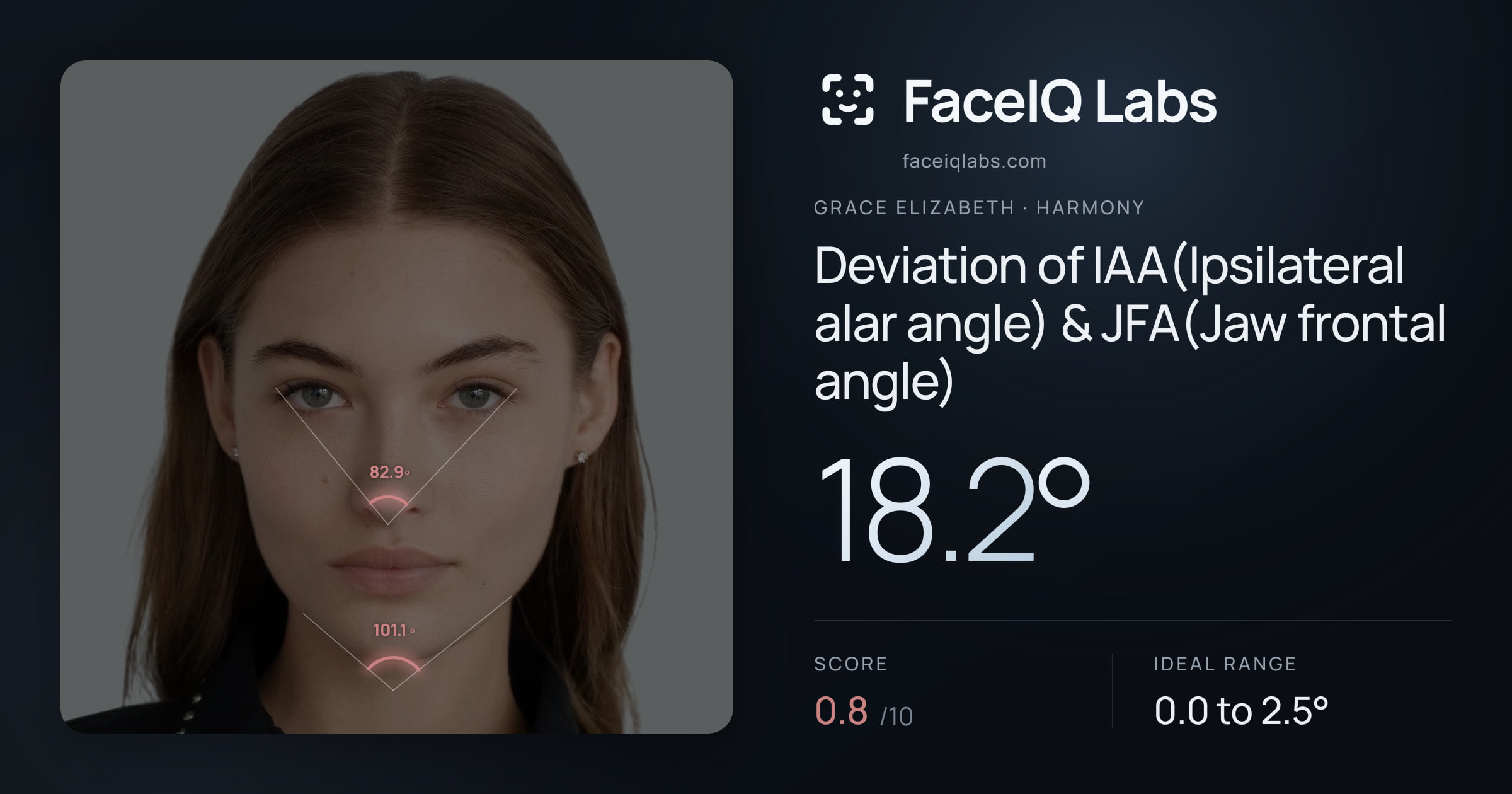 Grace Elizabeth Deviation of IAA(Ipsilateral alar angle) & JFA(Jaw frontal angle): 18.2°, drawn on the photo